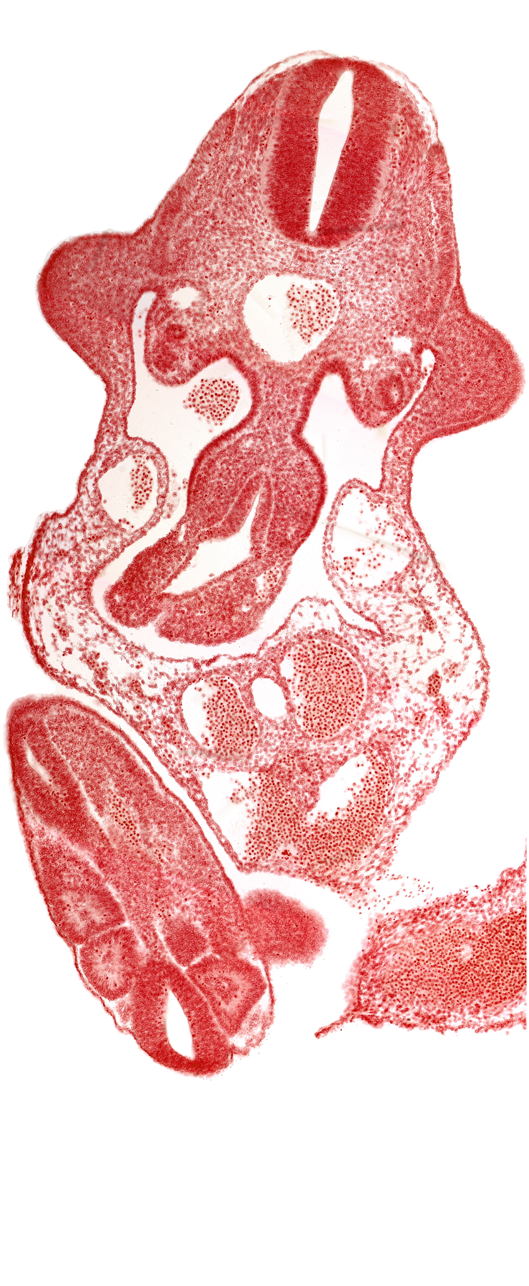 alar plate(s), allantois, aorta, basal plate, caudal plexus of veins, coelomic cavity, dermatomyotome 11 (C-7), junction of midgut and omphalo-enteric duct, neural canal, paraxial mesoderm, somite 30 (S-1), somite 31 (S-2), somite 32 (S-3), sulcus limitans, upper limb bud