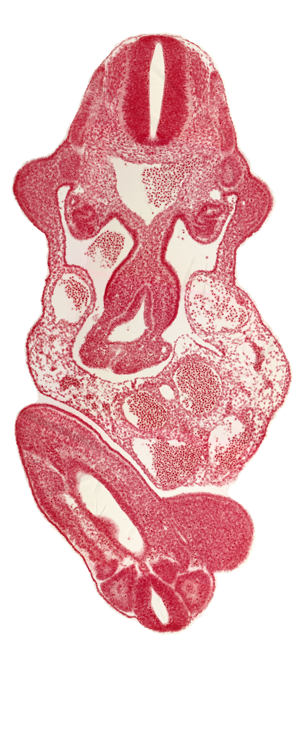 abdominal wall, allantois, aorta, caudal eminence, cloaca, dermatomyotome 11 (C-7), intersegmental artery, left umbilical artery, lower limb bud, mesonephric duct, origin of primary intestinal plexus artery, somite 29 (L-5), somite 30 (S-1), somite 31 (S-2), upper limb bud