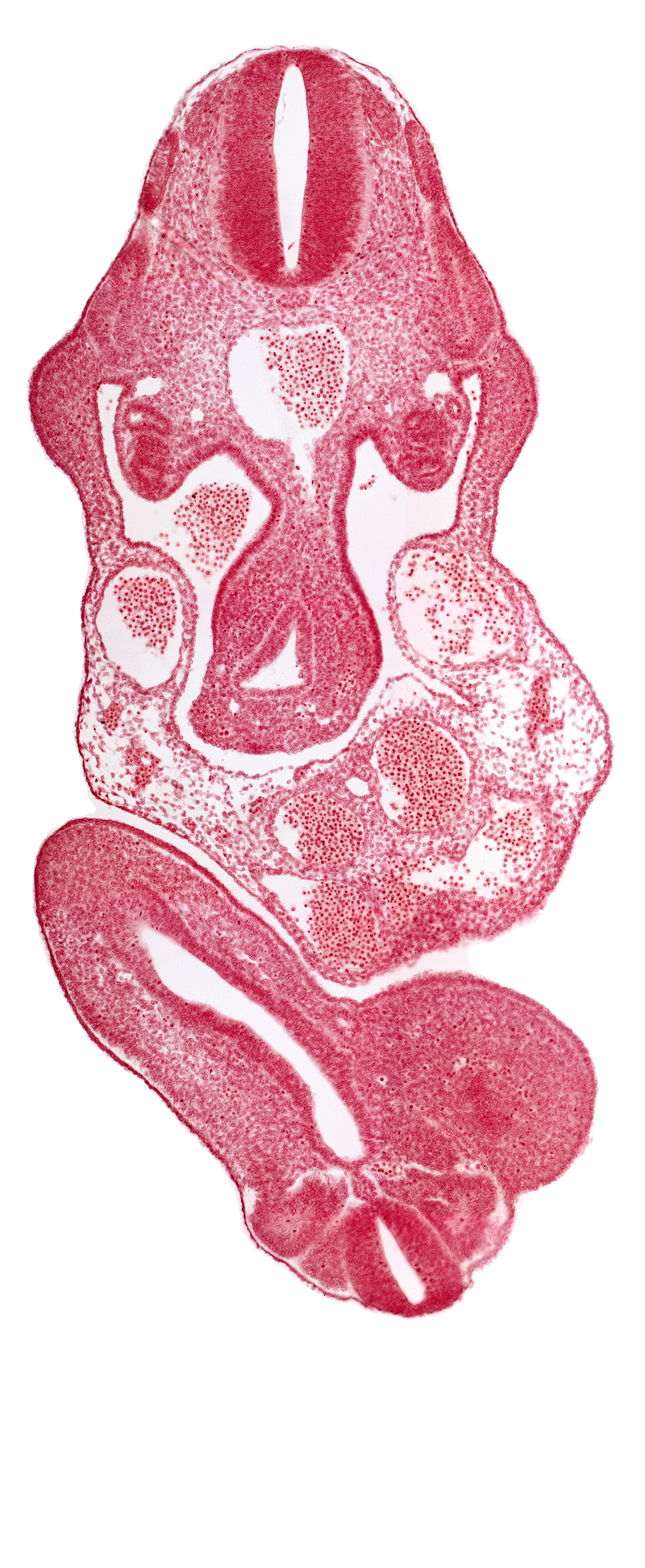 C-7 spinal ganglion primordium, allantois, aorta, cloaca, dermatomyotome 11 (C-7), dermatomyotome 12 (C-8), left umbilical artery, lower limb bud, mesonephric duct, midgut, neural canal, neural tube, postcardinal vein, primary intestinal plexus artery, right umbilical artery, right umbilical vein, somite 29 (L-5), somite 30 (S-1), subcardinal vein