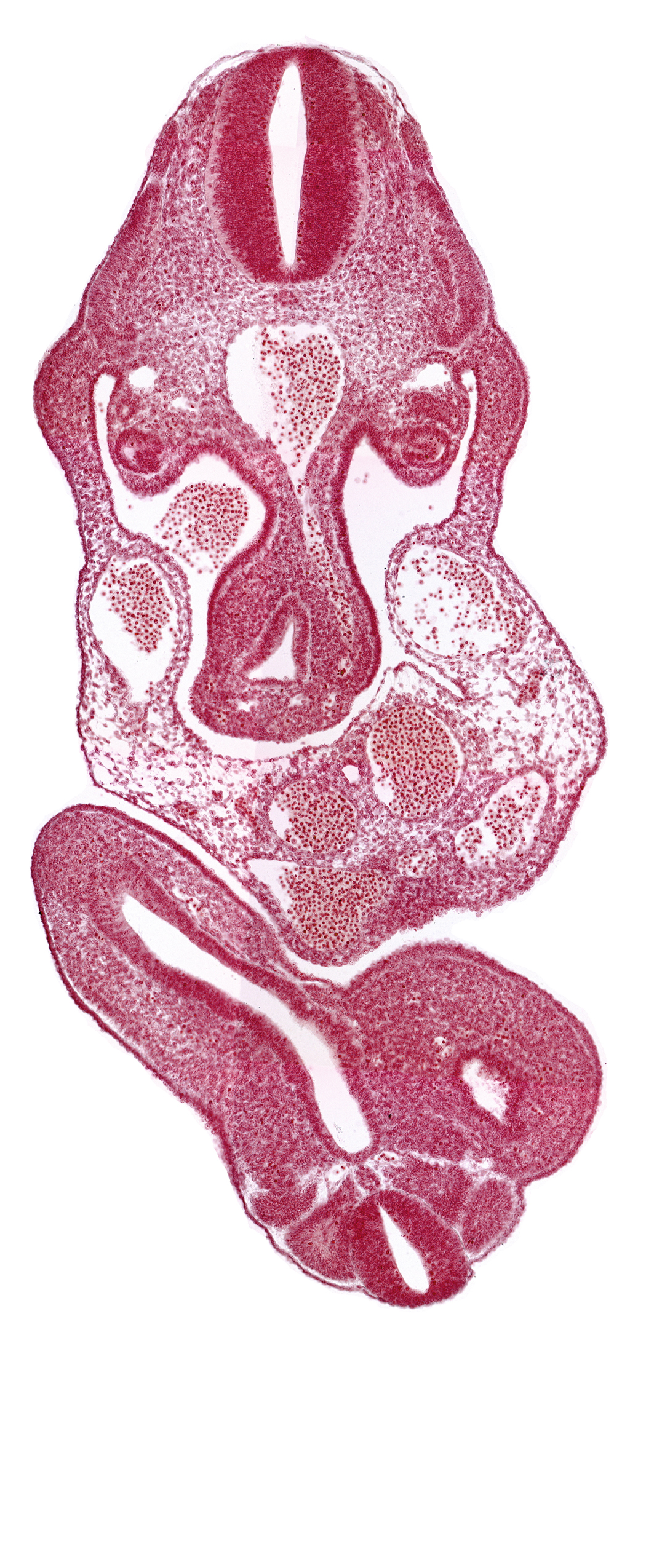 aorta, cloaca, dermatomyotome 11 (C-7), dermatomyotome 12 (C-8), junction of cloaca and mesonephric duct, mesonephric duct, notochord, postcardinal vein, somite 28 (L-4), somite 29 (L-5), subcardinal vein