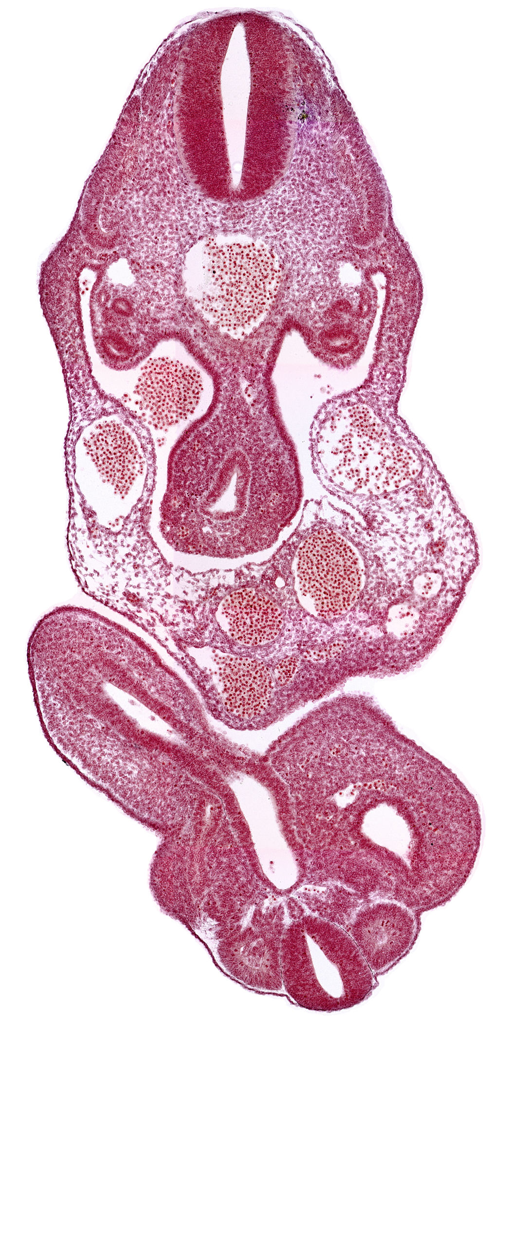 C-8 spinal ganglion primordium, caudal eminence, cloaca, coelom, dermatomyotome 12 (C-8), left umbilical artery, left umbilical vein, lower limb bud, mesonephric duct, mesonephric vesicle(s), notochord, right umbilical vein, somite 28 (L-4), tail gut