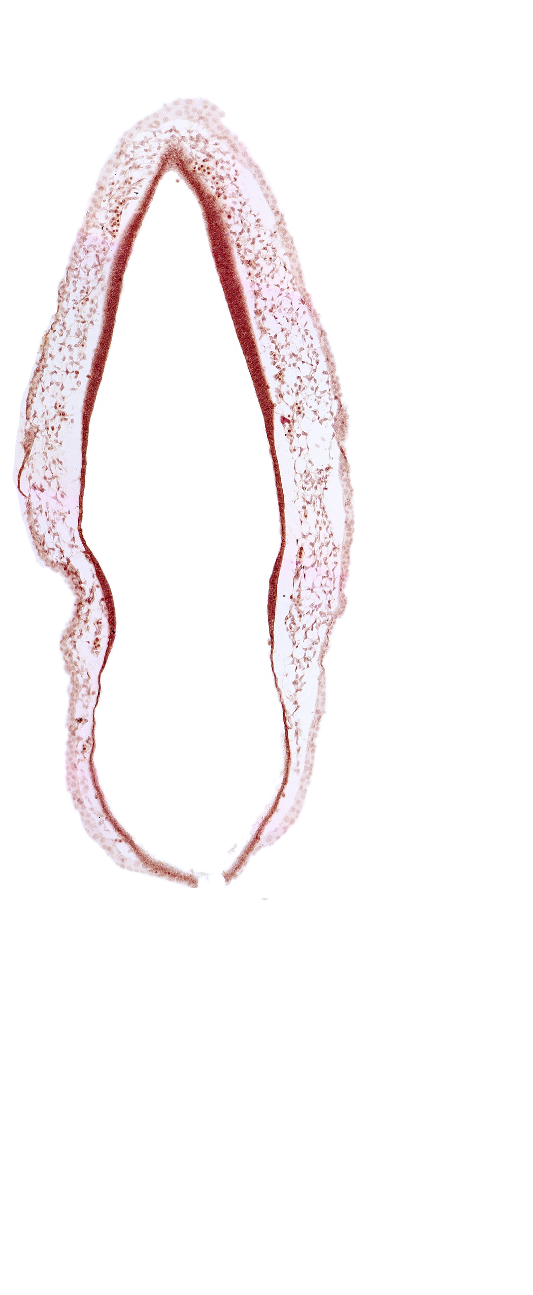 alar plate(s), head mesenchyme, rhombencoel (fourth ventricle), roof plate of rhombencephalon, surface ectoderm, venous plexus(es)