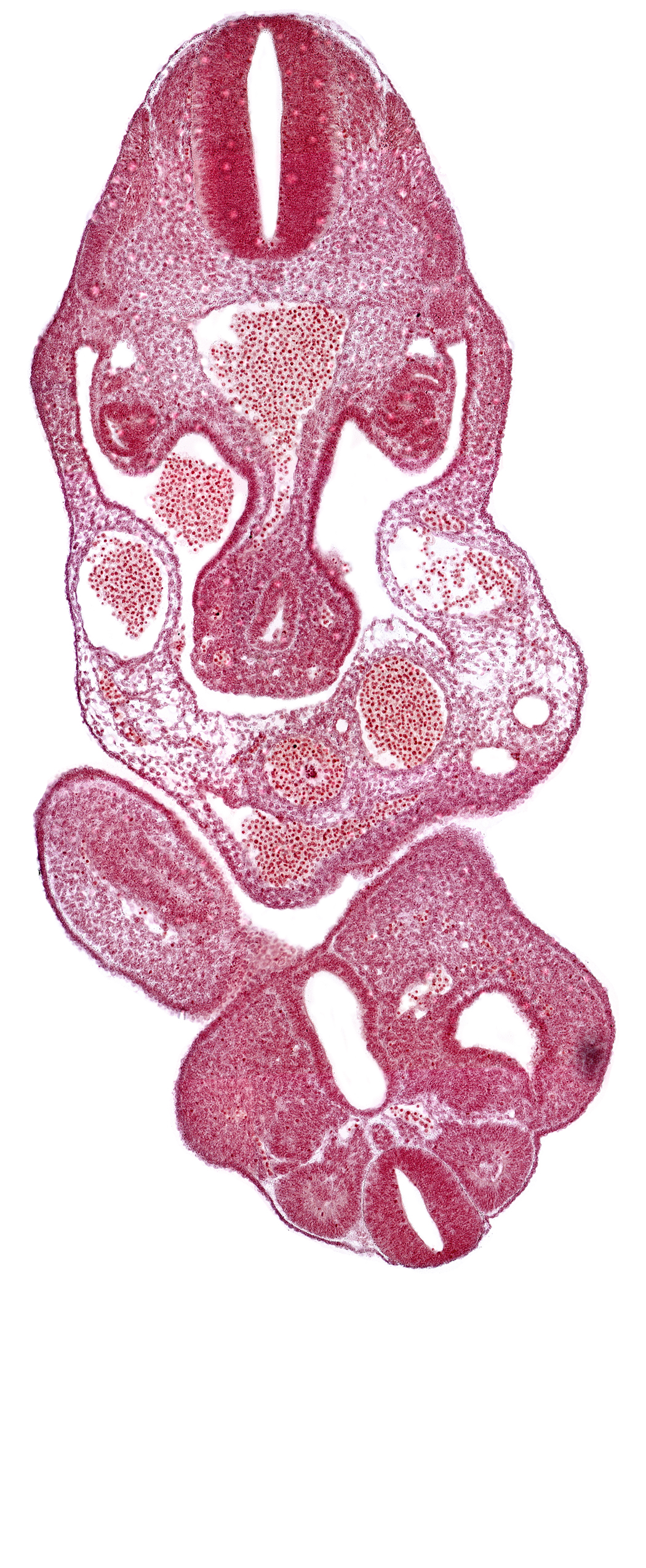 caudal eminence, cloaca, cloacal membrane, coelom, dermatomyotome 12 (C-8), left umbilical artery, left umbilical vein, lower limb bud, notochord, primary intestinal plexus artery, right umbilical vein, somite 28 (L-4)