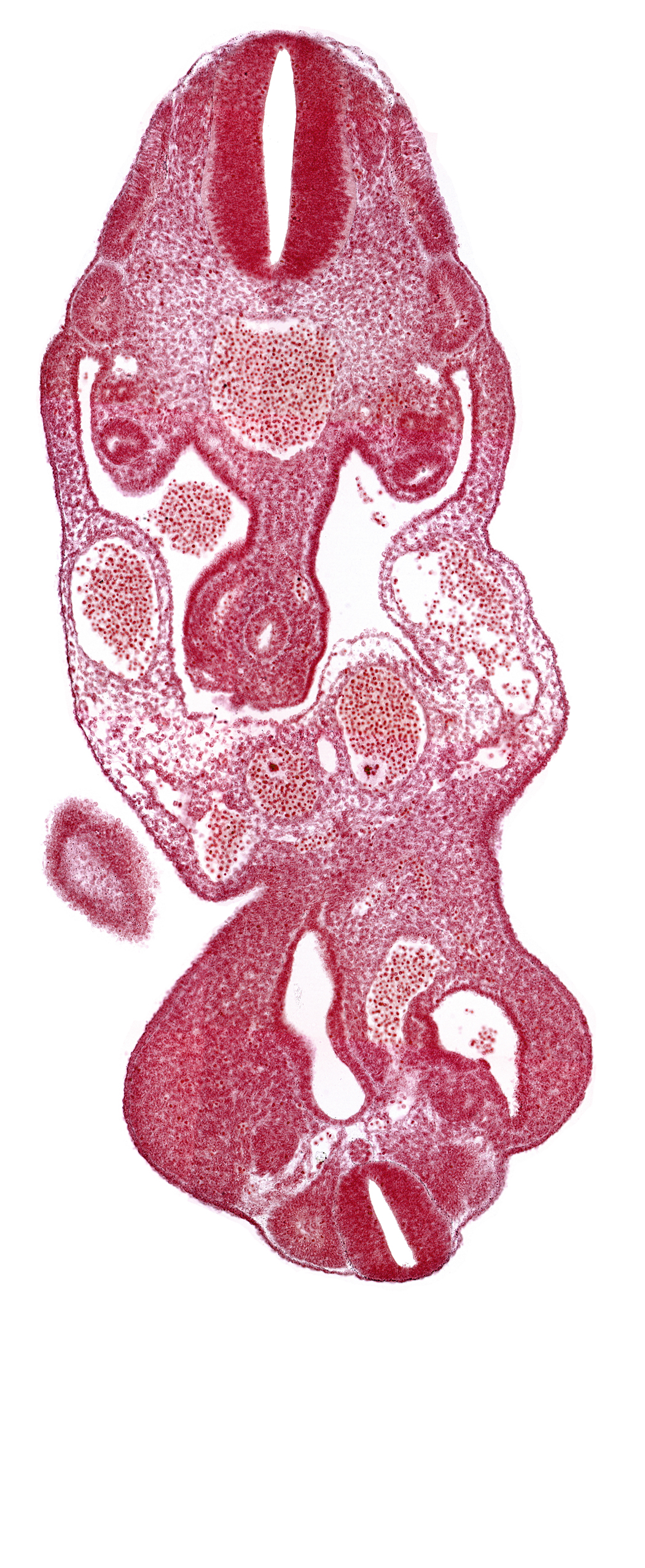 T-1 spinal ganglion primordium, aorta, cloaca, coelom, dermatomyotome 13 (T-1), edge of caudal eminence, left umbilical artery, left umbilical vein, lower limb bud, mesonephric duct, notochord, right umbilical vein