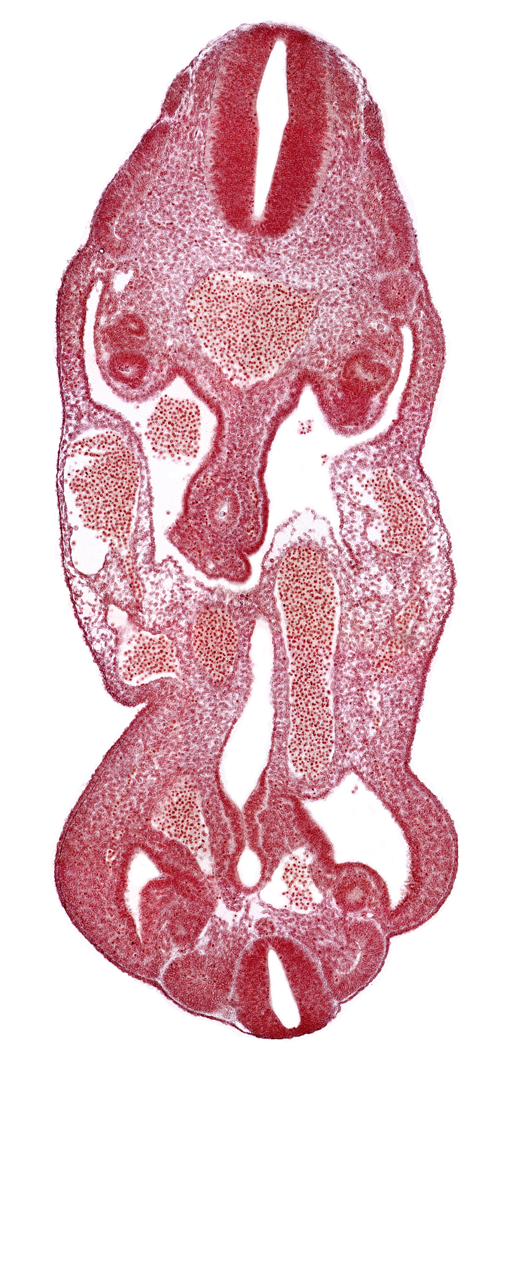 T-1 spinal ganglion primordium, aorta, coelom, dermatomyotome 14 (T-2), dermatomyotome 27 (L-3), gonadal epithelium, hindgut, left common iliac artery, left umbilical artery, lower limb bud, mesonephric ridge, neural canal, notochord, rectum primordium, urogenital sinus, urorectal septum