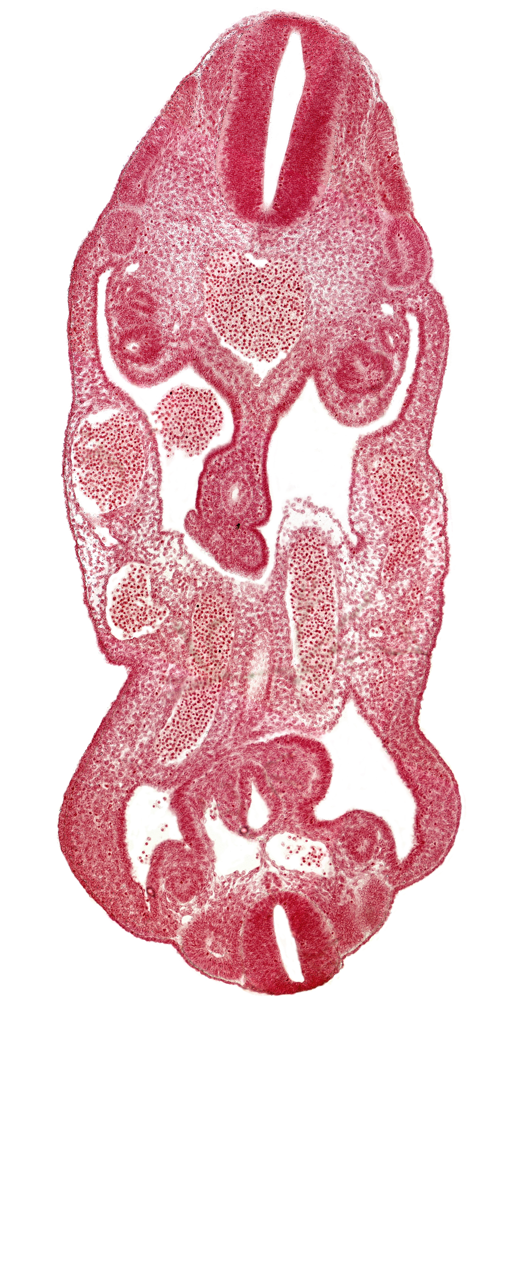 aorta, coelom, dermatomyotome 14 (T-2), dermatomyotome 26 (L-2), hindgut, left common iliac artery, left umbilical artery, mesonephric duct, neural canal, notochord, right common iliac artery, right umbilical vein