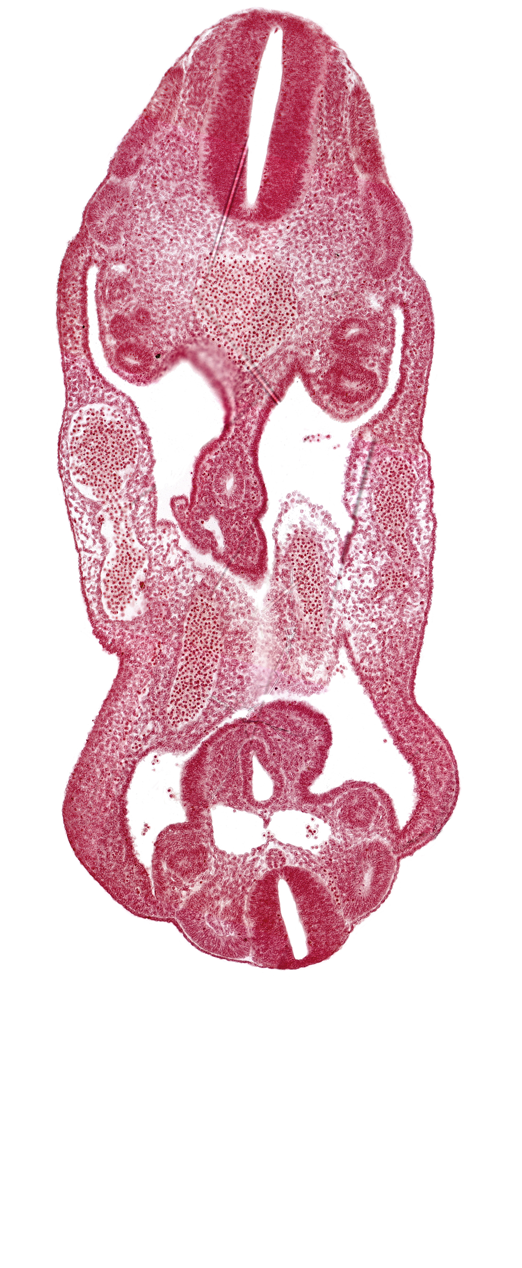 aorta, coelom, dermatomyotome 14 (T-2), dermatomyotome 26 (L-2), left common iliac artery, left umbilical artery, mesonephric duct, neural canal, right common iliac artery, right umbilical artery, right umbilical vein