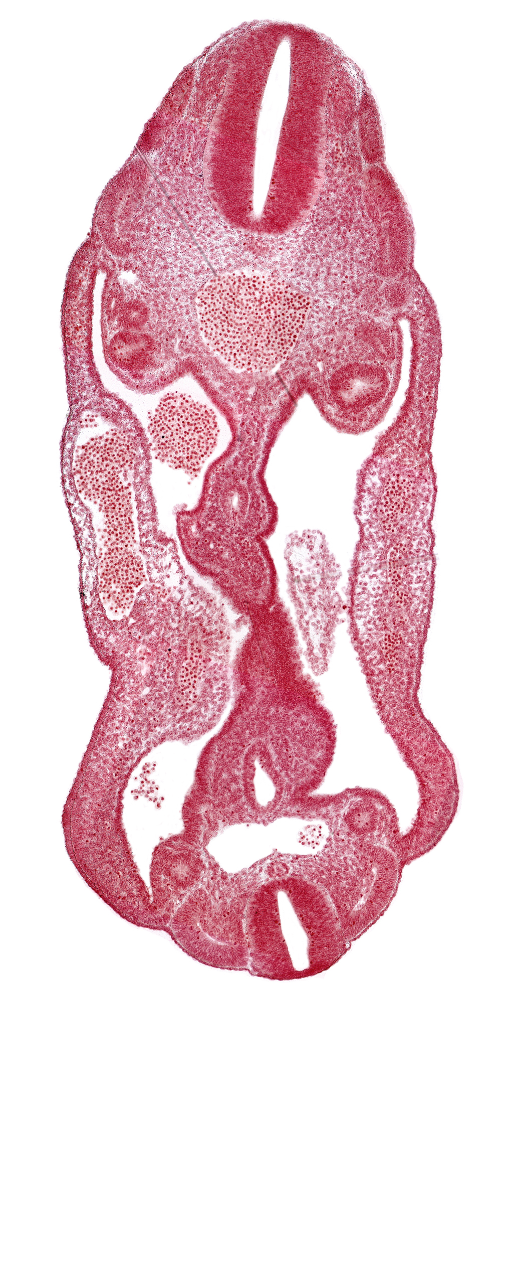 aorta, aortic bifurcation, coelom, dermatomyotome 14 (T-2), dermatomyotome 15 (T-3), dermatomyotome 26 (L-2), hindgut, mesentery, mesonephric duct, mesonephric vesicle(s), neural canal, neural tube