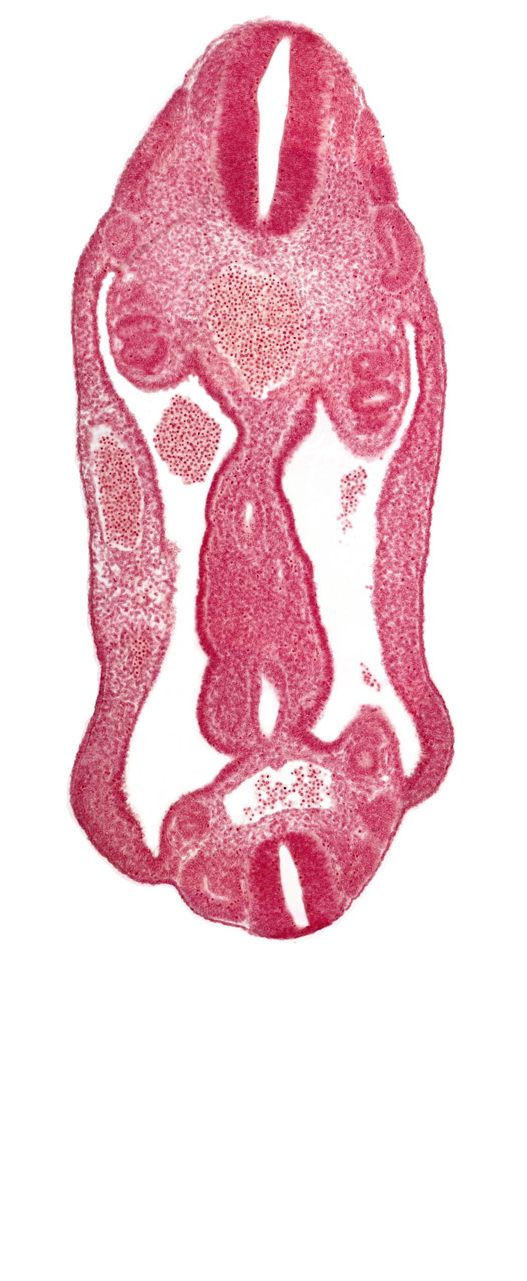 aorta, aortic bifurcation, coelom, dermatomyotome 15 (T-3), dermatomyotome 16 (T-4), dermatomyotome 26 (L-2), hindgut, mesentery, neural tube, notochord