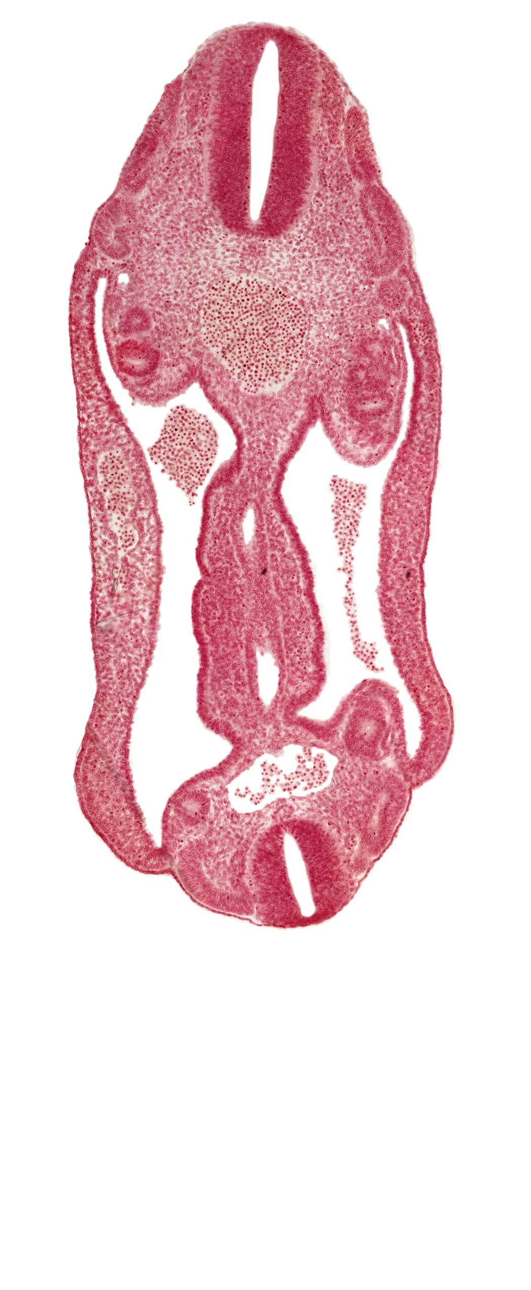T-3 spinal ganglion primordium, aorta, aortic bifurcation, coelom, continuity of hindgut, dermatomyotome 15 (T-3), dermatomyotome 16 (T-4), dermatomyotome 25 (L-1), hindgut, mesentery, mesonephric duct, neural tube, sclerotome