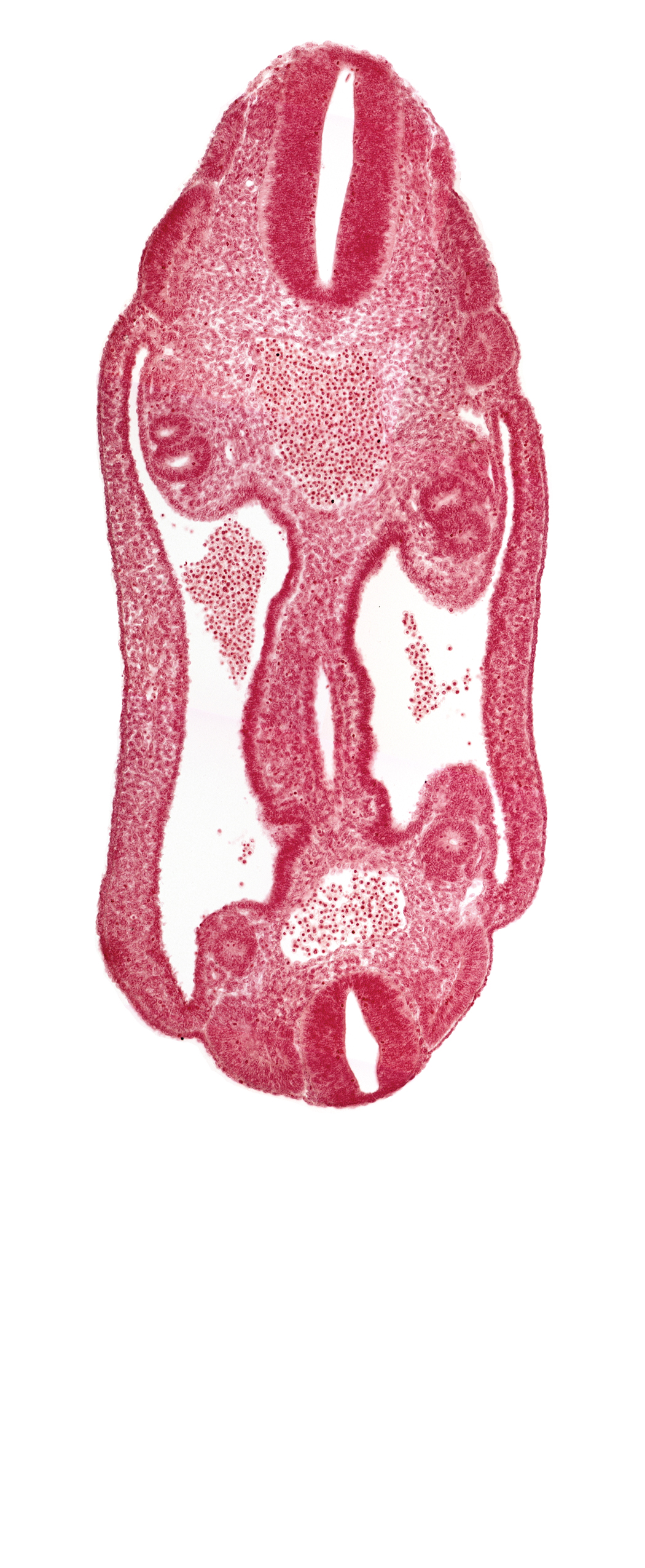 aorta, coelom, dermatomyotome 15 (T-3), dermatomyotome 16 (T-4), dermatomyotome 17 (T-5), dermatomyotome 25 (L-1), mesothelium, neural tube, sclerotome, somatic mesoderm, splanchnic mesoderm