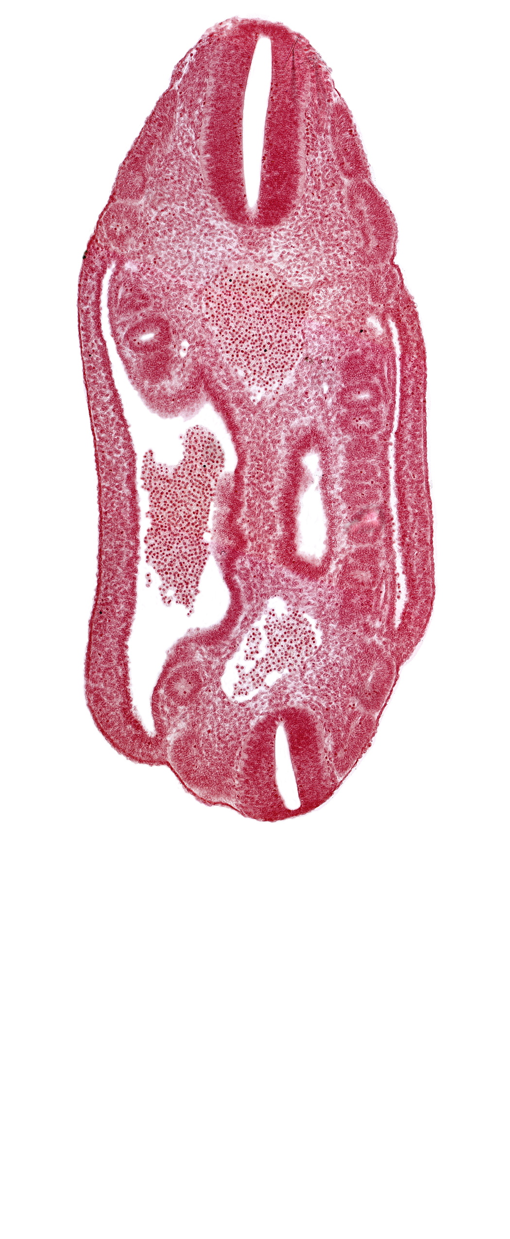 aorta, coelom, dermatomyotome 16 (T-4), dermatomyotome 17 (T-5), dermatomyotome 18 (T-6), dermatomyotome 24 (T-12), dermatomyotome 25 (L-1), dorsal mesentery, lateral body wall, mesonephric vesicle(s), mesothelium, neural tube, notochord, roof plate of neural tube
