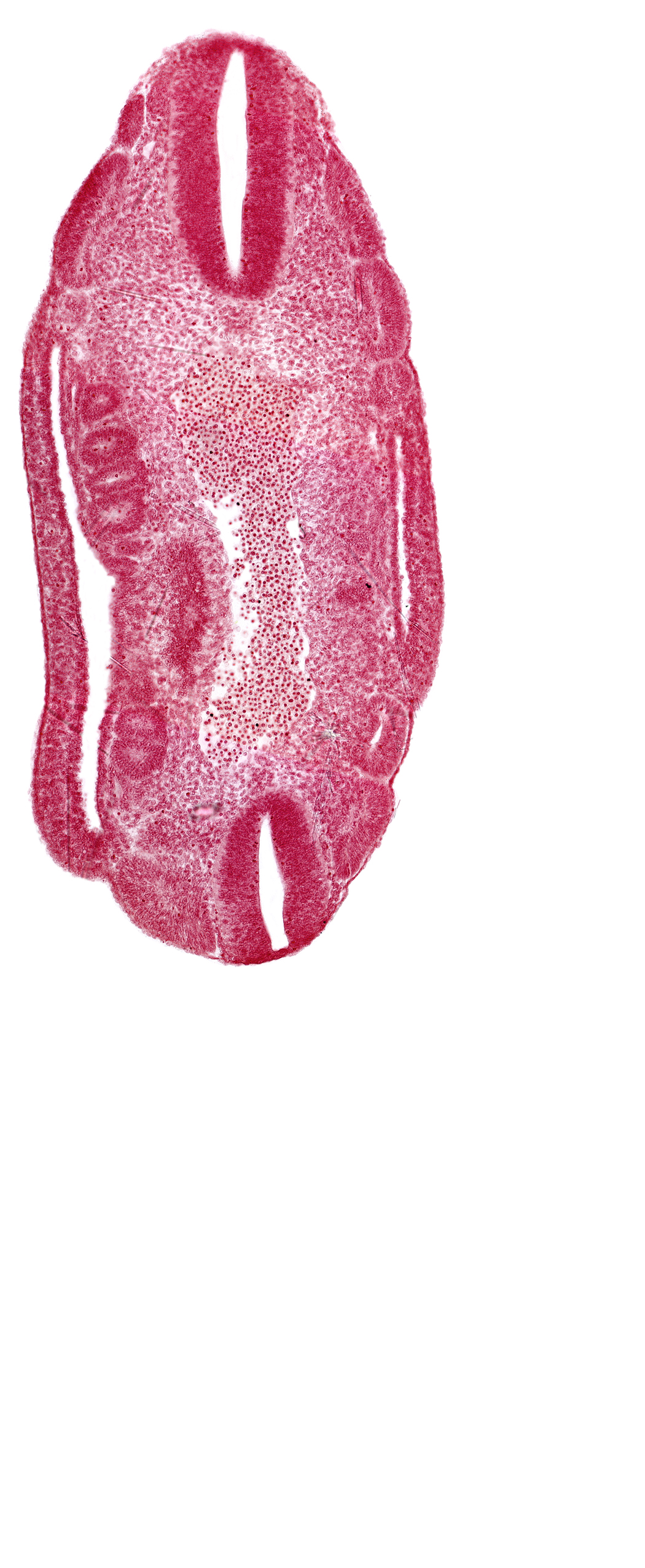 aorta, coelom, dermatomyotome 17 (T-5), dermatomyotome 18 (T-6), dermatomyotome 19 (T-7), dermatomyotome 23 (T-11), dermatomyotome 24 (T-12), edge of coelom, mesonephric vesicle(s)