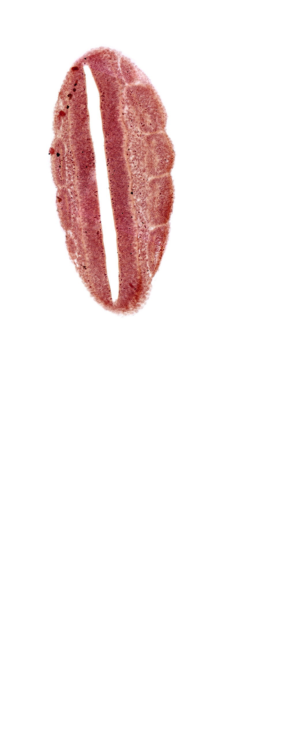 dermatomyotome 20 (T-8), dermatomyotome 21 (T-9), lumen of neural tube, neural tube, sclerotome