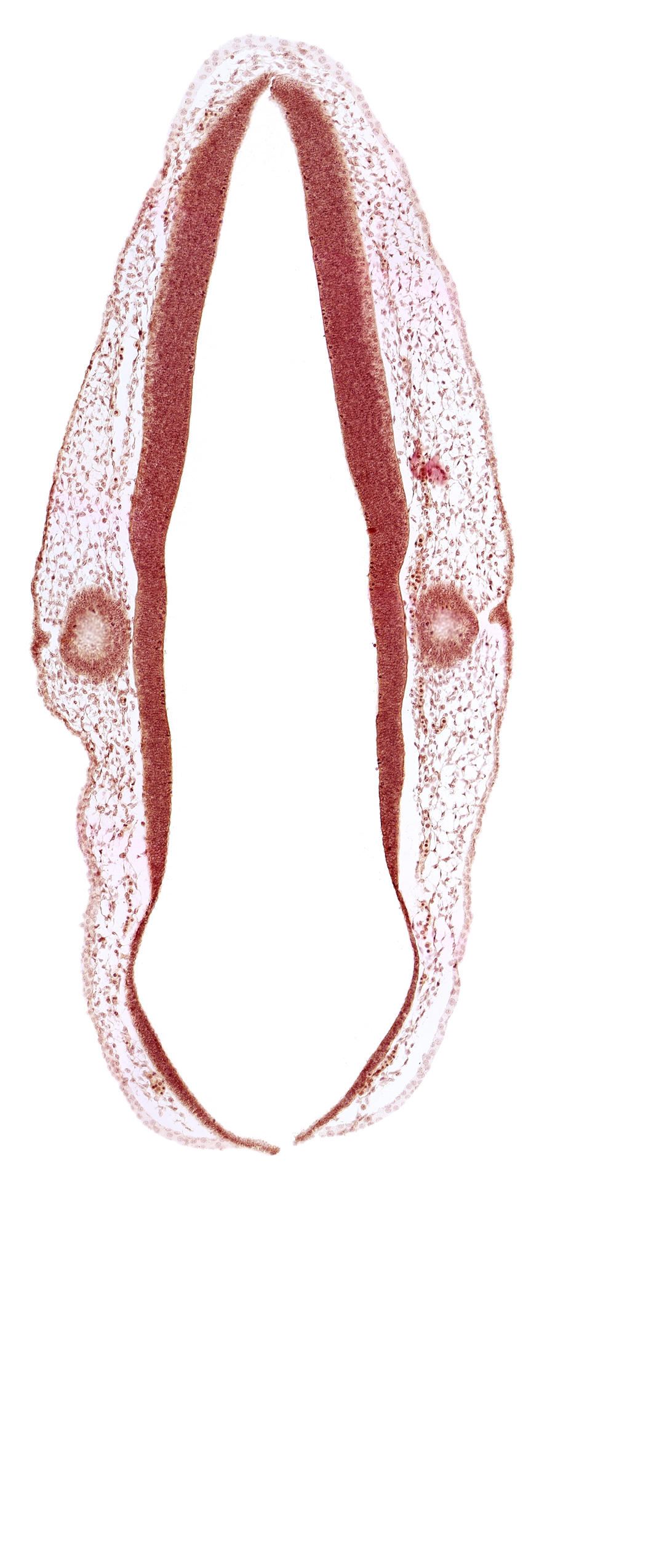 alar plate of rhombencephalon, ectodermal tag of otic vesicle, otic vesicle, rhombencoel (fourth ventricle), roof plate of rhombencephalon