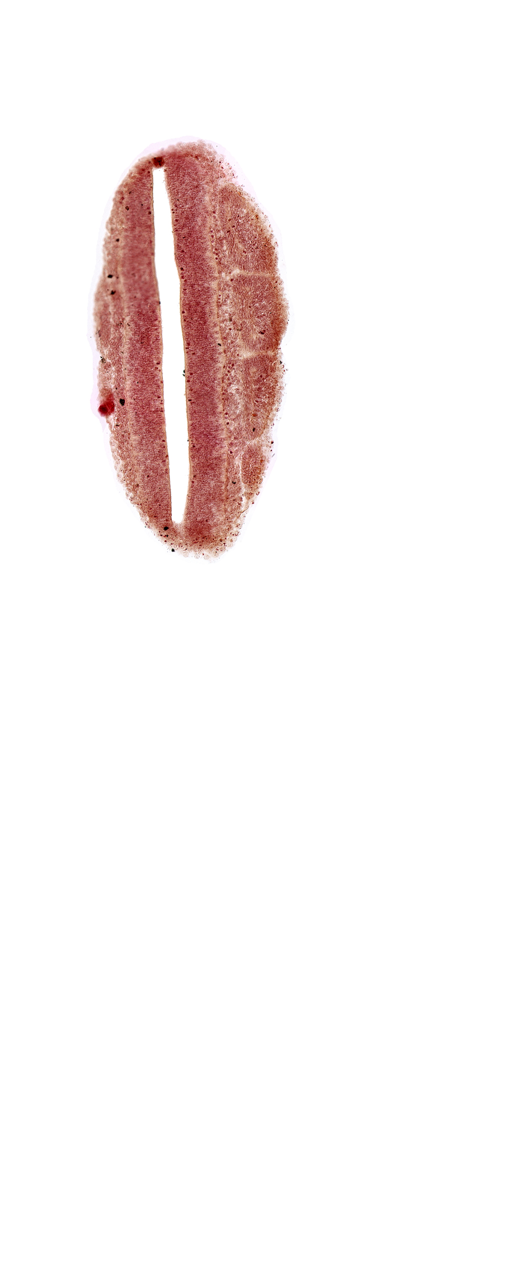 dermatomyotome 21 (T-9), lumen of neural tube, mantle layer, neural tube
