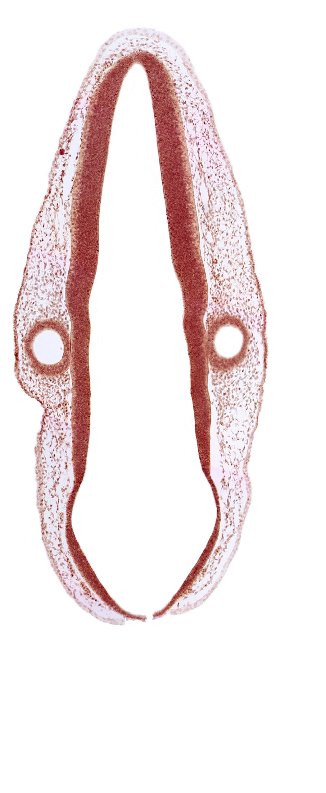 mantle layer, marginal layer, otic vesicle, otic vesicle cavity, posterior dural venous plexus, rhombencoel (fourth ventricle), rhombomere 6, surface ectoderm