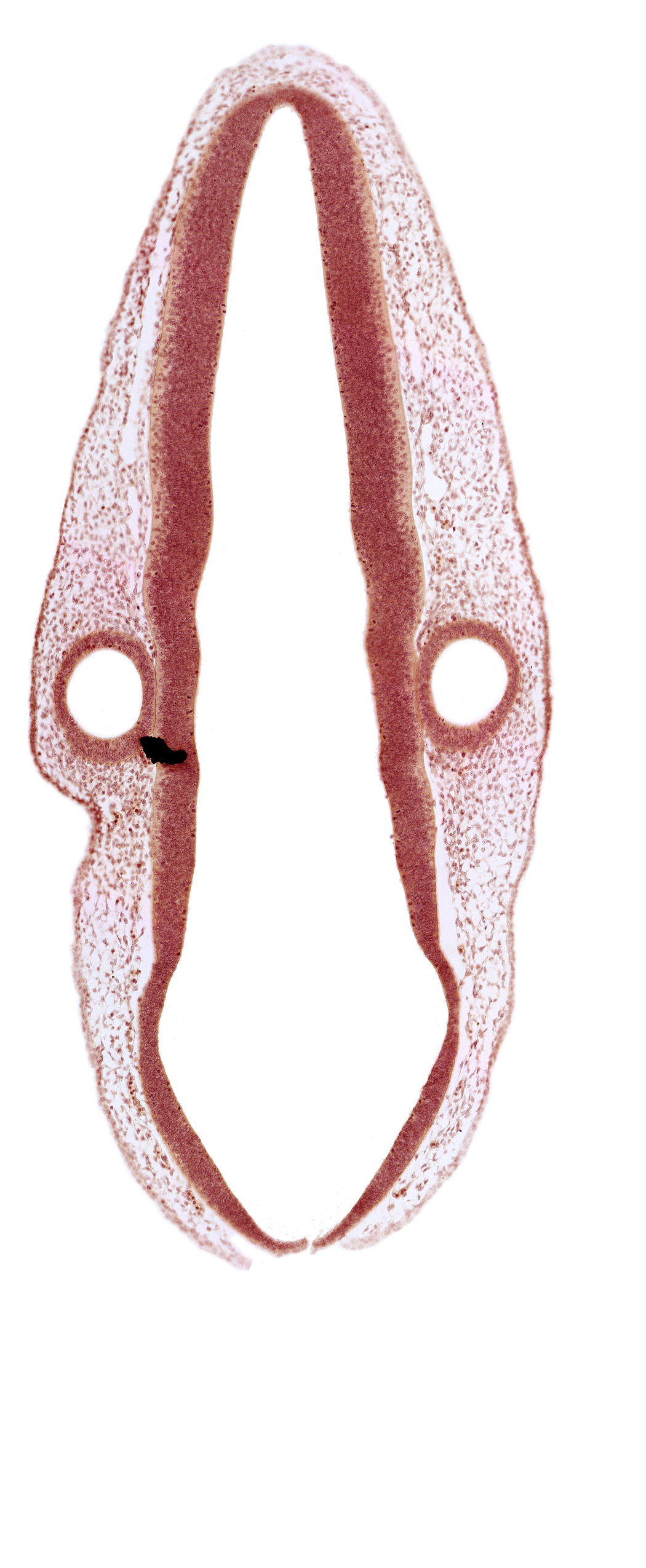 head mesenchyme, mantle layer, marginal layer, otic vesicle, otic vesicle cavity, posterior dural venous plexus, rhombencoel (fourth ventricle), rhombomere 6, roof plate, surface ectoderm