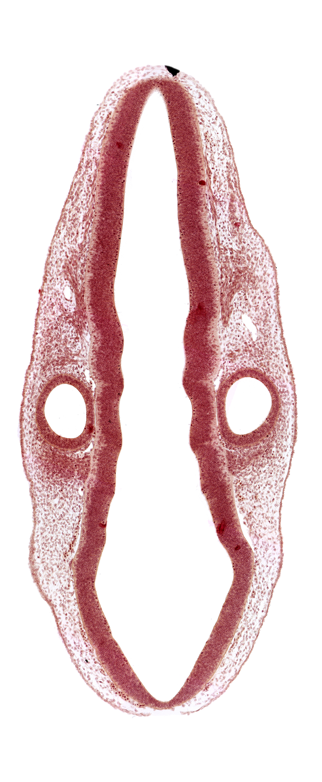 cephalic edge of dermatomyotome 1 (O-1), head mesenchyme, otic vesicle, posterior dural venous plexus, primordium of vagus and accessory nerves (CN X and CN XI), rhombomere 6, root of facial nerve (CN VII), root of glossopharyngeal nerve (CN IX), root of vestibulocochlear nerve (CN VIII), surface ectoderm