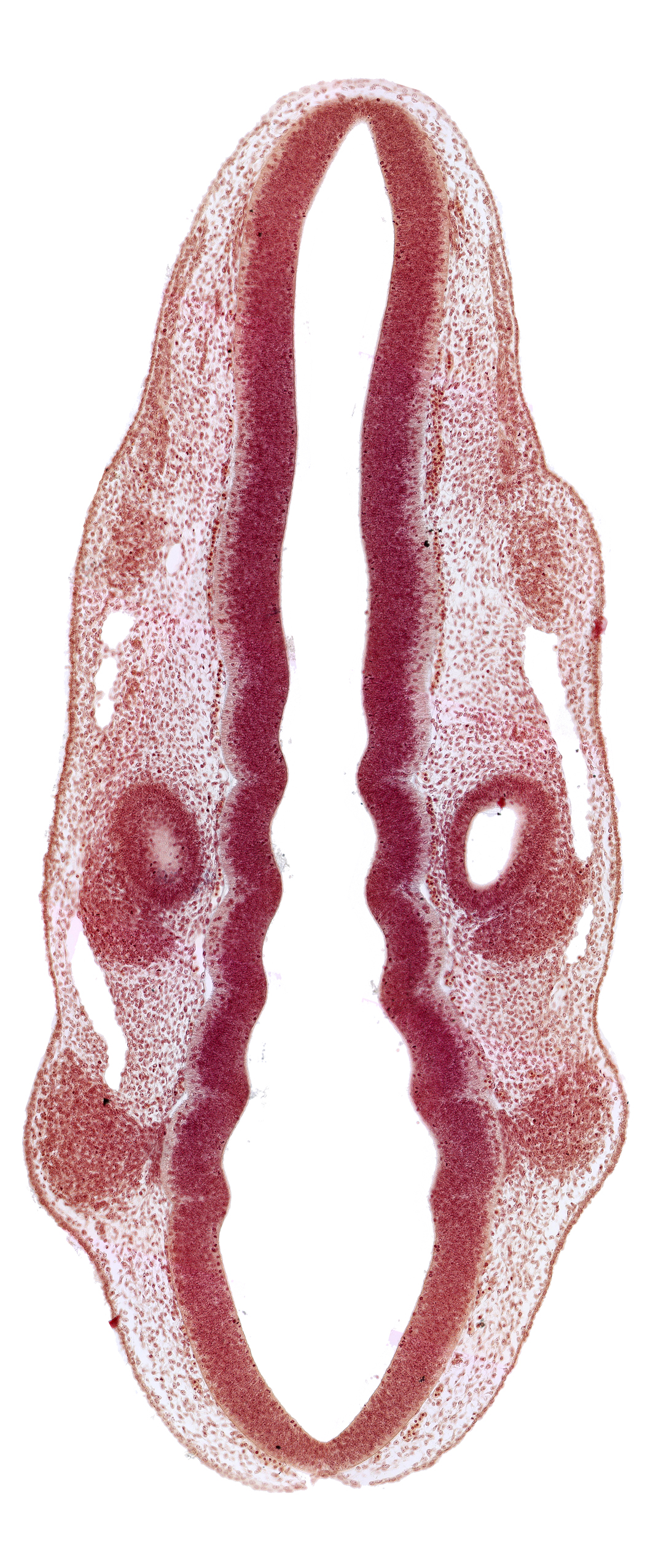 dermatomyotome 1 (O-1), dermatomyotome 2 (O-2) , marginal layer, otic vesicle, primary head vein, primordium of facial and vestibulocochlear nerves (CN VII and CN VIII), primordium of trigeminal nerve (CN V), primordium of vagus nerve (CN X), rhombencoel (fourth ventricle), rhombomere 2, rhombomere 4, rhombomere 7