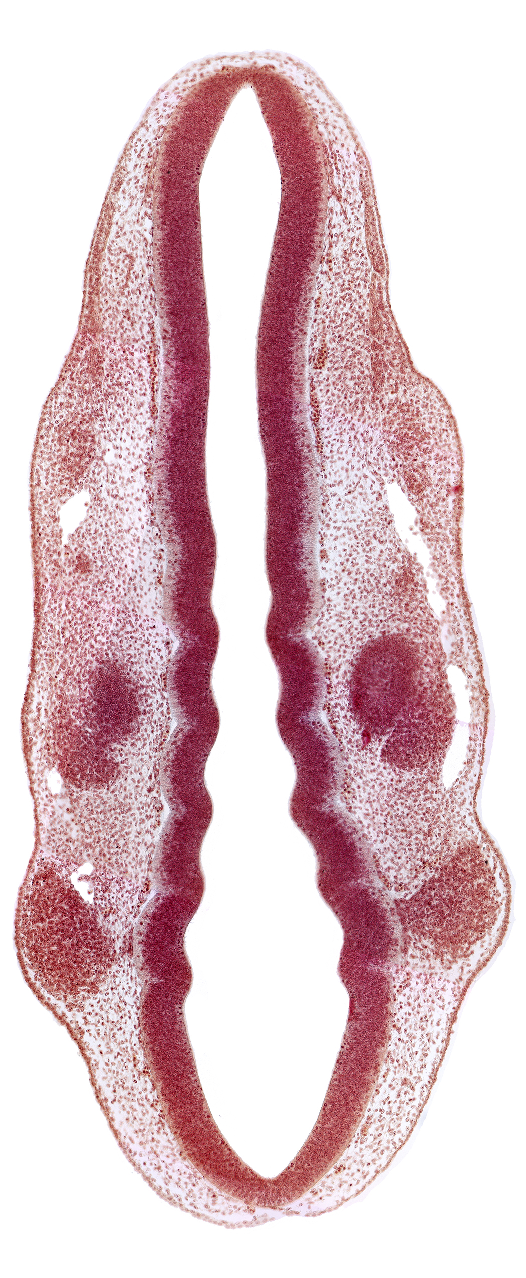 caudal edge of otic vesicle, dermatomyotome 1 (O-1), dermatomyotome 2 (O-2) , primary head vein, primordium of facial and vestibulocochlear nerves (CN VII and CN VIII), primordium of trigeminal nerve (CN V), primordium of vagus nerve (CN X), rhombencoel (fourth ventricle), rhombomere 2, rhombomere 3, rhombomere 4, rhombomere 6, rhombomere 7