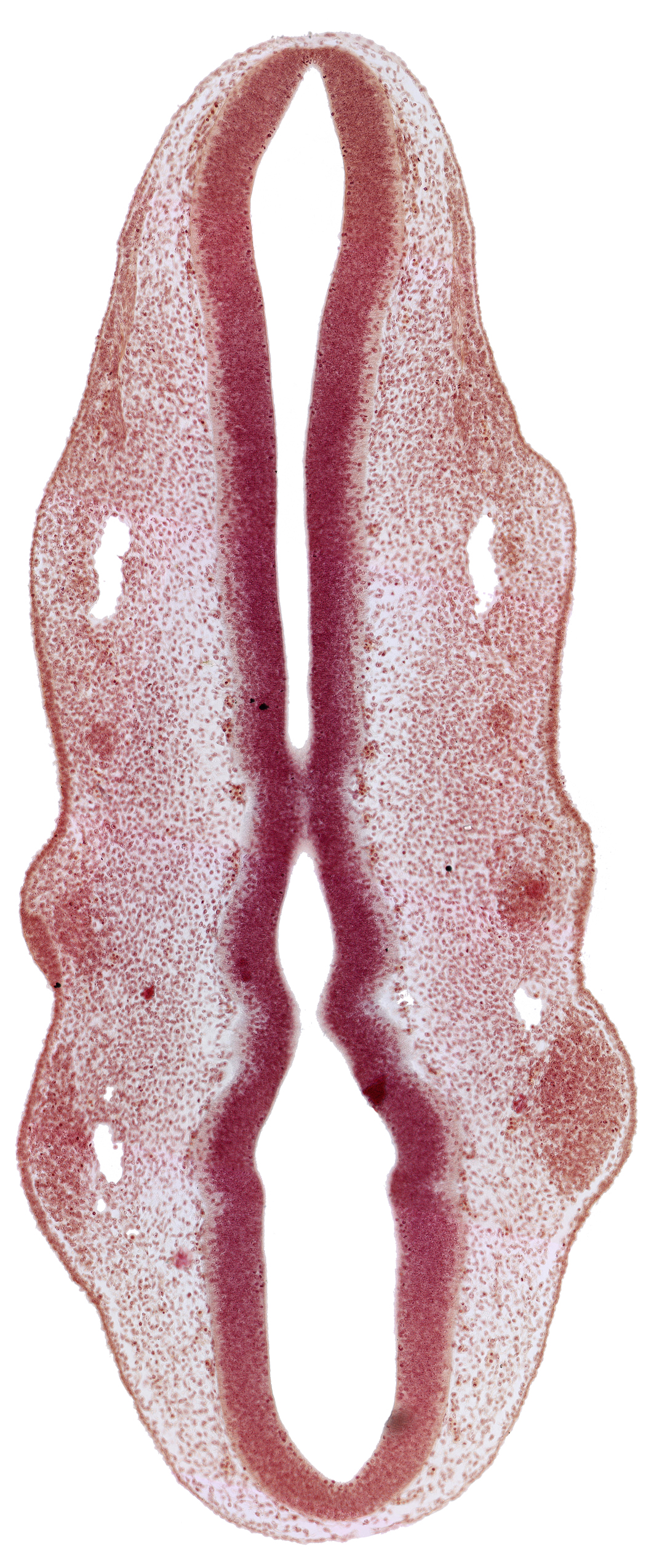 dermatomyotome 2 (O-2) , primary head vein, primordium of facial nerve (CN VII), primordium of glossopharyngeal nerve (CN IX), primordium of trigeminal nerve (CN V), rhombomere 2, rhombomere 4