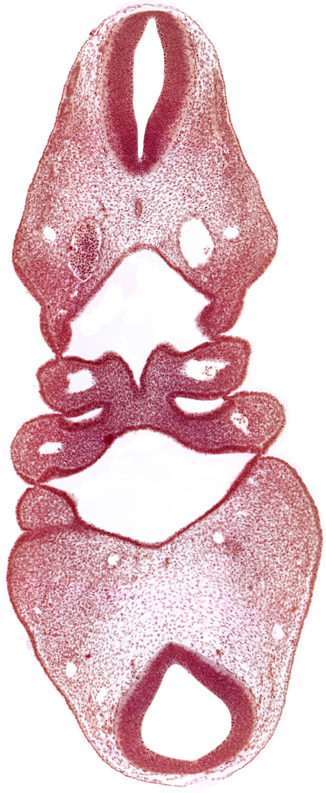 aortic arch 2, copula of tongue, dermatomyotome 4 (O-4) , dorsal aorta, mandibular prominence of pharyngeal arch 1, notochord, pharyngeal arch 2, pharyngeal pouch 1, precardinal vein, region of cervical flexure, region of mesencephalic (cephalic) flexure