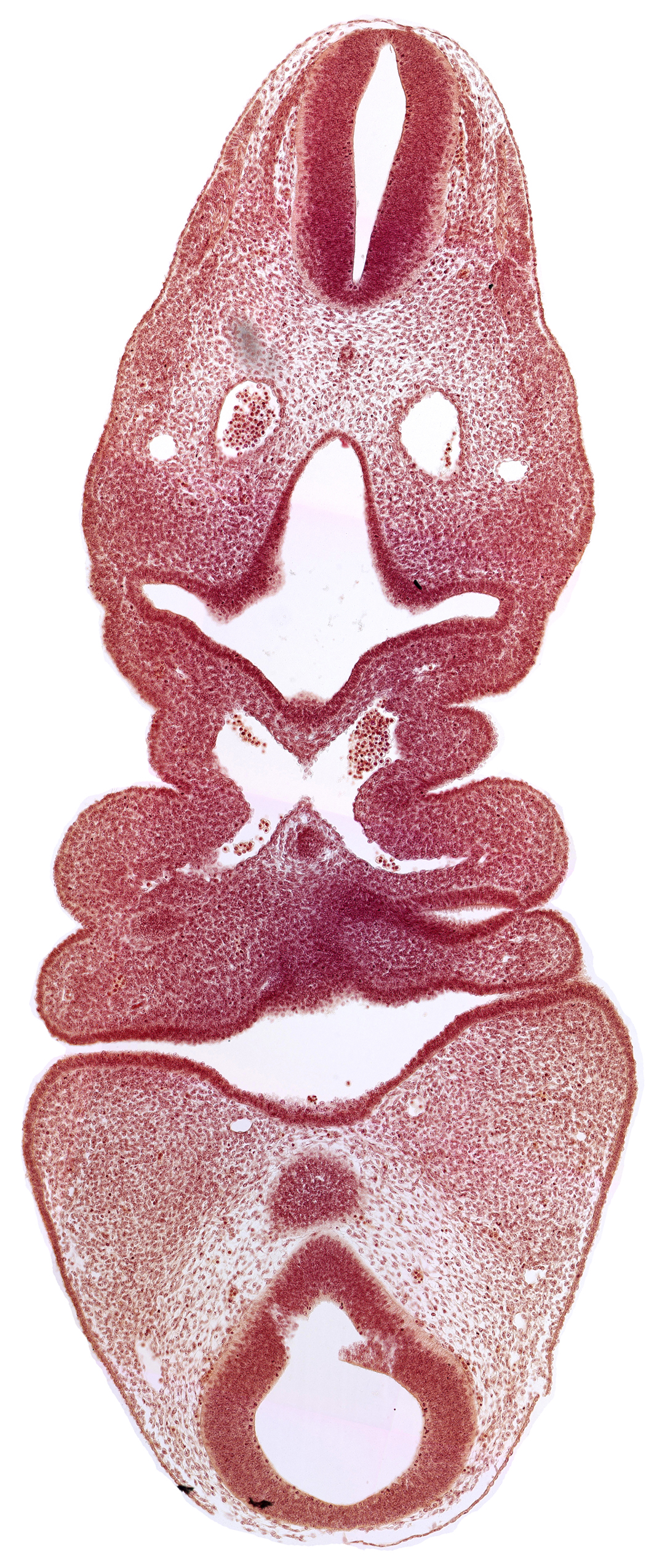 aortic arch 2, aortic sac, caudal edge of thyroid diverticulum, dermatomyotome 5 (C-1), dorsal aorta, internal carotid artery, lateral tongue eminence, mamillary recess, median tongue eminence, mesencephalon, oral fissure, pharyngeal arch 3, pharyngeal pouch 4, pharynx primordium