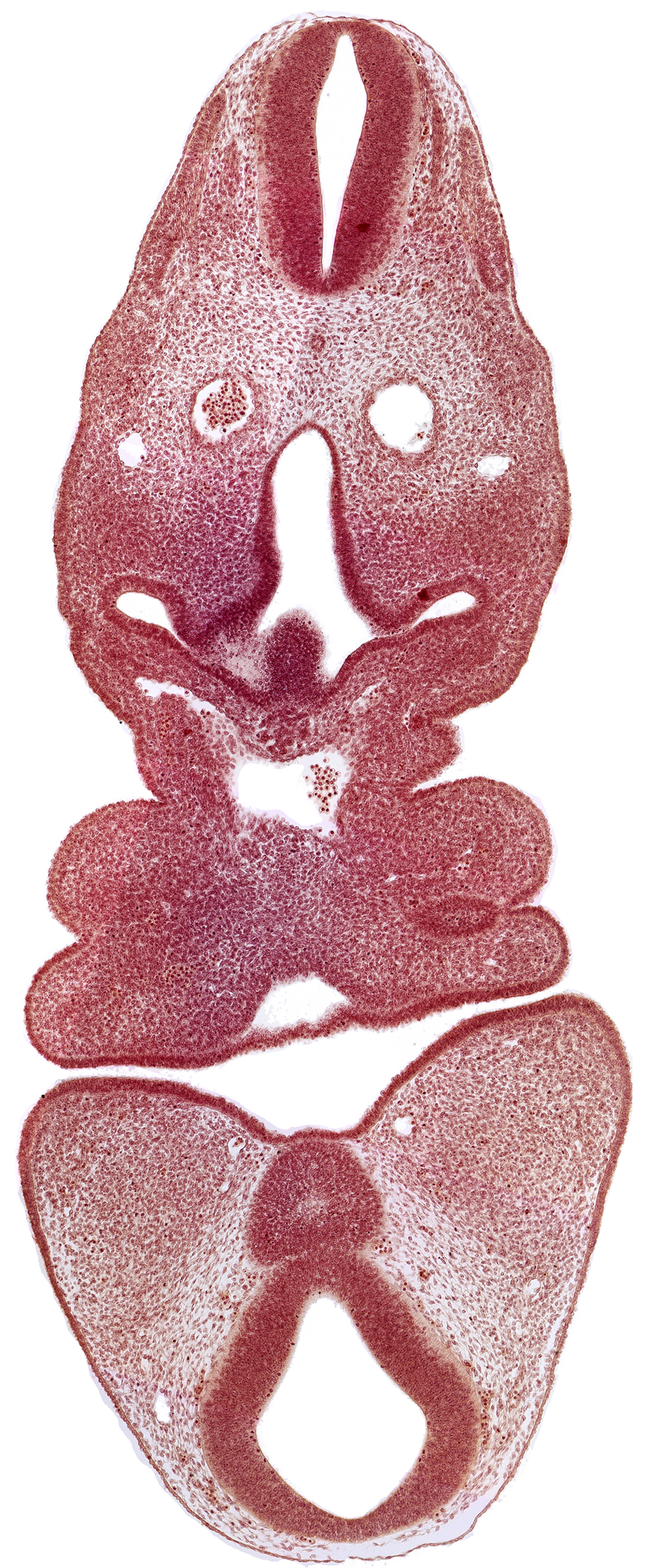 aortic sac, cervical sinus, dermatomyotome 5 (C-1), dorsal aorta, internal carotid artery, junction of aortic arch 2 and aortic sac, junction of aortic arch 4 and aortic sac, mamillary recess, mandibular prominence of pharyngeal arch 1, maxillary prominence of pharyngeal arch 1, mesencephalon, pharyngeal arch 2, pharyngeal pouch 1, precardinal vein, ultimopharyngeal pouch
