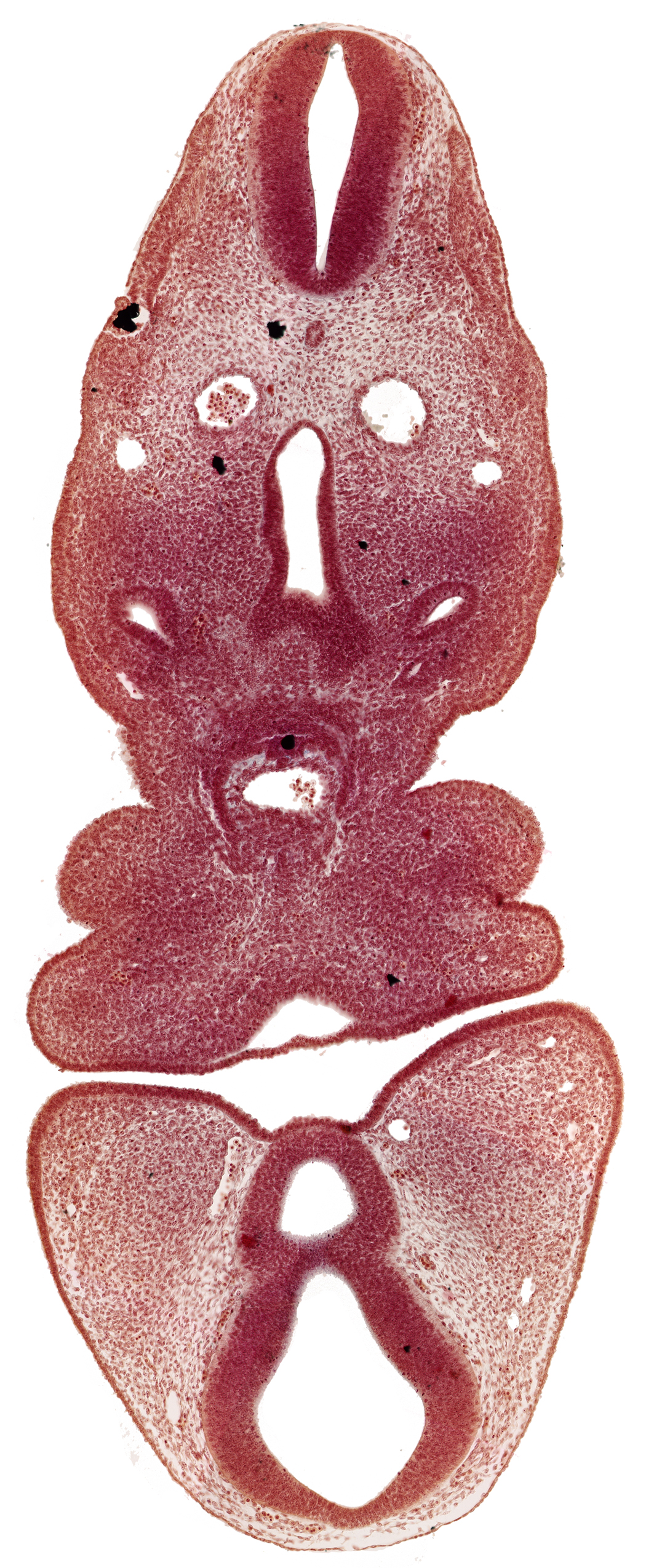 anterior dural venous plexus, dermatomyotome 5 (C-1), dorsal aorta, internal carotid artery, mamillary recess, mandibular prominence of pharyngeal arch 1, maxillary prominence of pharyngeal arch 1, oral fissure, pharyngeal arch 2, pharyngeal groove 1, precardinal vein, prosencoel (third ventricle), truncus arteriosus, ultimopharyngeal pouch