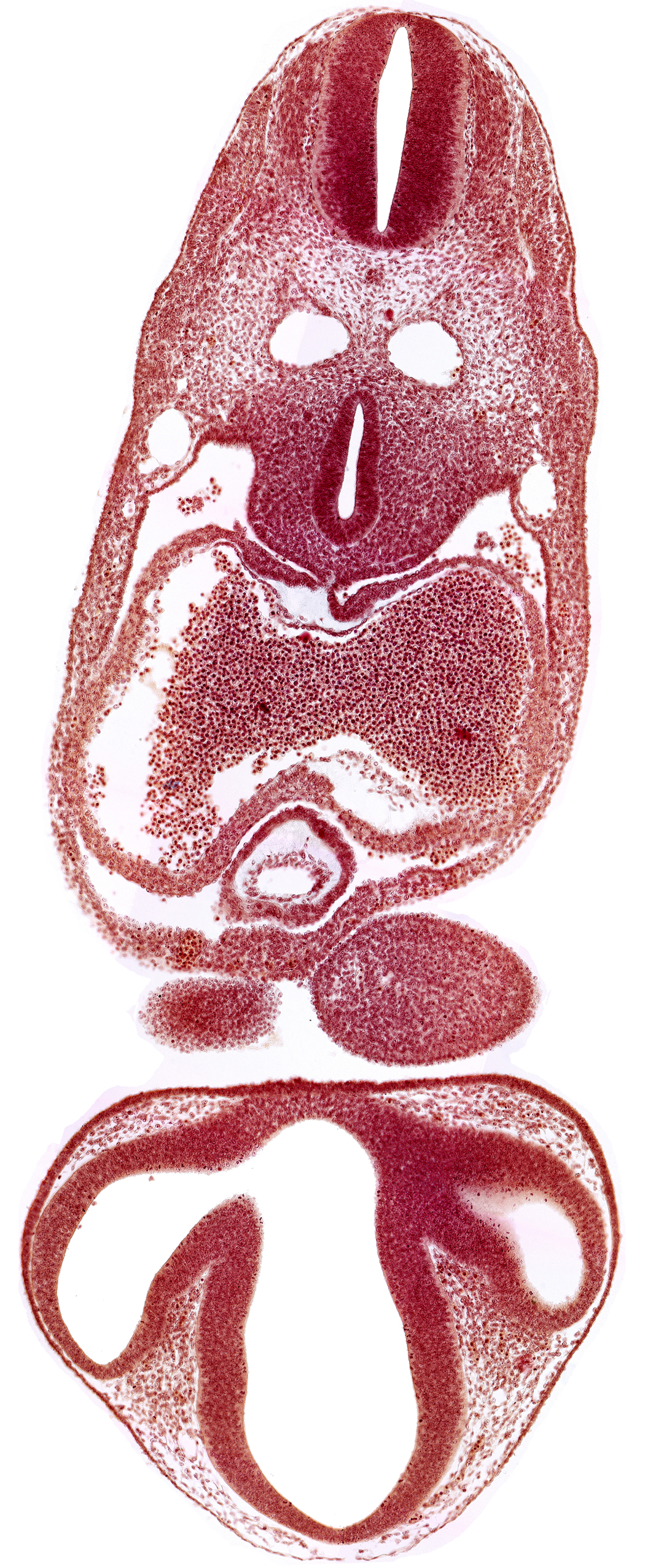 C-2 spinal ganglion primordium, caudal edge of pharyngeal arch 1, dermatomyotome 6 (C-2), dorsal aorta, dorsal thalamus, epithalamus, interatrial foramen (primum), intraretinal space (optic vesicle cavity), junction of conus cordis and truncus arteriosus, left atrium, mesocardium, notochord, optic vesicle, pericardial cavity, precardinal vein, prosencoel (third ventricle), right atrium, stomodeum, tracheo-esophageal tube, ventral thalamus