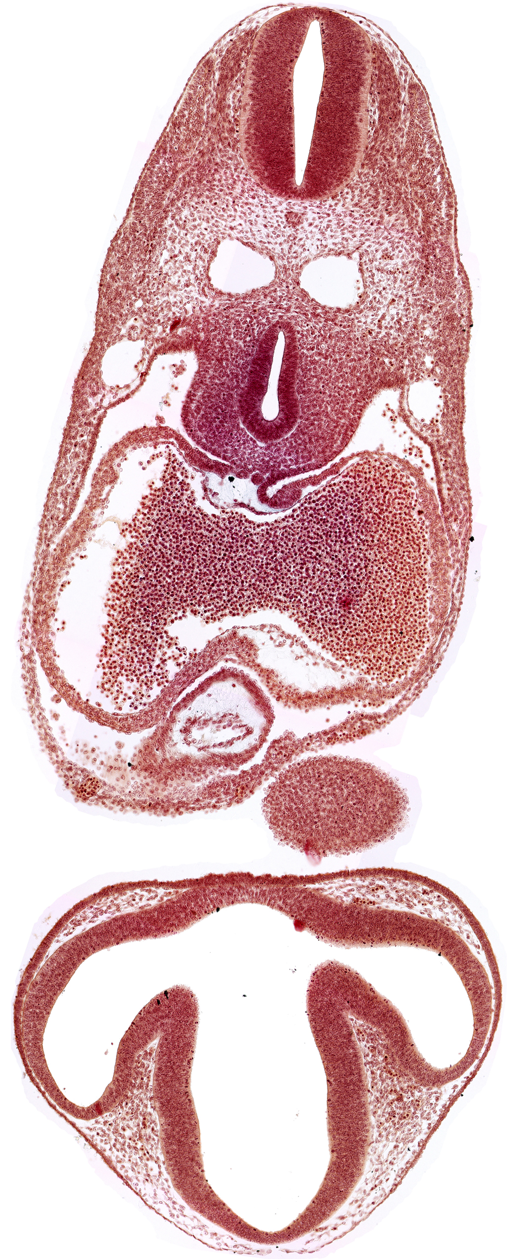 C-2 spinal ganglion primordium, dermatomyotome 6 (C-2), dorsal thalamus, epithalamus, left atrium, mandibular prominence of pharyngeal arch 1, mesocardium, notochord, optic vesicle, pericardial cavity, precardinal vein, prosencoel (third ventricle), right atrium, tracheo-esophageal tube, ventral thalamus