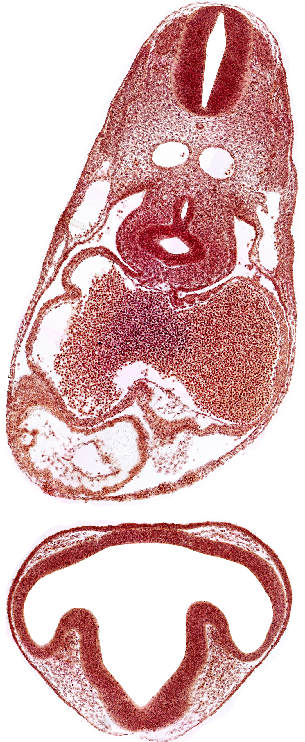 C-2 spinal ganglion primordium, blood cells in left atrium, conus cordis, dermatomyotome 6 (C-2), diencephalon, endocardium, epimyocardium, esophagus primordium, intraretinal space (optic vesicle cavity), mesocardium, notochord, optic part of retina, optic stalk (CN II), ostium primum, pericardial cavity, pericardial sac, pericardioperitoneal canal (pleural cavity), precardinal vein, prosencoel (third ventricle), right aorta, right atrium, right lung bud, sinus venosus