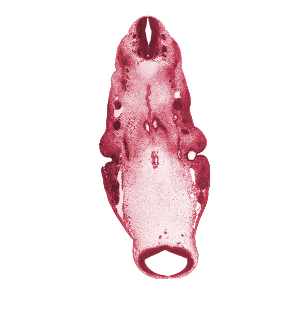 C-1 spinal ganglion, C-1 ventral root, cephalic edge of pharynx, fused basilar artery, inferior ganglion of glossopharyngeal nerve (CN IX), inferior ganglion of vagus nerve (CN X), junction of dorsal aorta and internal carotid artery, maxillary nerve (CN V₂), mesencephalon (M1), notochord, ophthalmic nerve (CN V₁), parachordal condensation, pharyngeal arch 1, pharyngeal groove 1, pharyngeal pouch 1, pontine flexure region, posterior cerebral artery, primary head vein, region of cervical flexure, spinal accessory nerve (CN XI), stem of anterior dural venous plexus, sulcus limitans, tectum of mesencephalon, tegmentum of mesencephalon