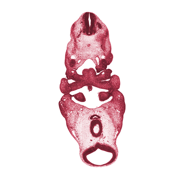 C-1 spinal nerve, aortic arch 3, aortic arch 4, cephalic edge of C-2 spinal ganglion, diencephalon, diencoel (third ventricle), dorsal aorta, edge of adenohypophysial pouch, hypopharyngeal eminence of tongue, inferior ganglion of vagus nerve (CN X), lateral lingual swelling of tongue, mesencephalon (M1), mesencoel (cerebral aqueduct), notochord, pharyngeal arch 3, pharyngeal arch 4, pharyngeal groove 1, pharyngeal pouch 2, posterior communicating artery, precardinal vein, spinal accessory nerve (CN XI), spinal cord, thyroglossal duct, tuberculum impar of tongue