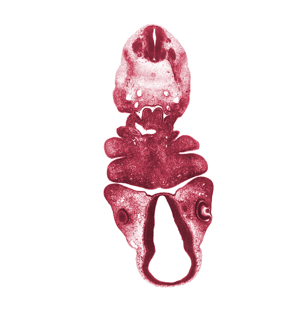 C-2 spinal nerve, aortic arch 4, aortic sac, caudal edge of C-2 spinal ganglion, cervical sinus, dorsal aorta, dorsal thalamus, edge of lens vesicle, edge of optic cup, edge of optic stalk (CN II), hypothalamus, inferior ganglion of vagus nerve (CN X), mandibular prominence of pharyngeal arch 1, maxillary prominence of pharyngeal arch 1, maxillary venous plexus, median mandibular groove, neural arch primordium, notochord, oral fissure, pharyngeal arch 2, pharyngeal arch 3, pharyngeal arch 4, pharyngeal groove 1, pharyngeal pouch 4, precardinal vein, pretectum, sulcus limitans, sulcus medius, synencephalon, ultimopharyngeal pouch, ventral thalamus