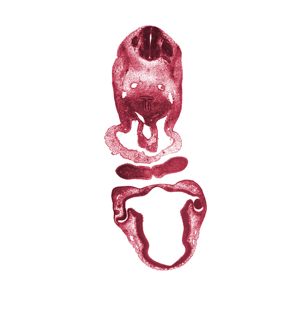 C-3 dorsal root, C-3 spinal ganglion, C-3 ventral root, alar plate(s), anterior dural venous plexus, aortic sac, basal plate, chiasmatic plate, diencoel (third ventricle), dorsal aorta, dorsal thalamus, edge of lens vesicle, external layer of optic cup, floor plate, internal layer of optic cup, intraretinal space (optic vesicle cavity), junction of maxillary and medial nasal prominences, laryngeal condensation, mandibular prominence of pharyngeal arch 1, median mandibular groove, optic stalk lumen (CN II), pericardial cavity, precardinal vein, pulmonary arch, roof plate, sulcus limitans, sulcus medius, ventral thalamus