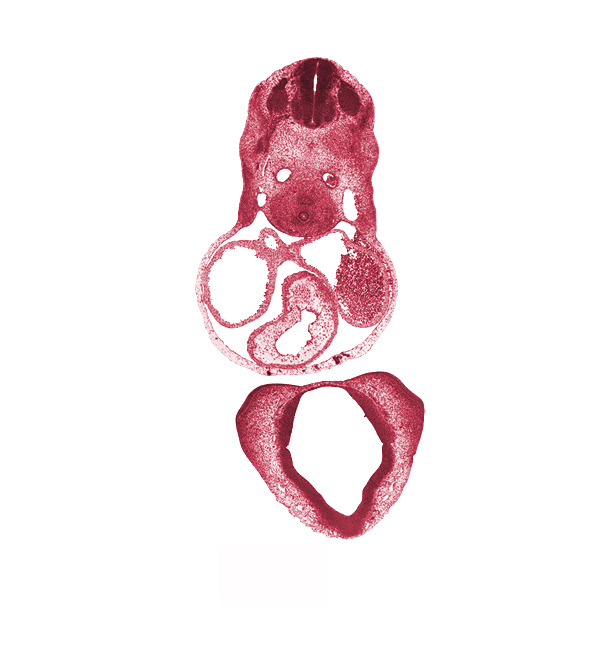 C-4 spinal ganglion, cerebral primordium (vesicle), conotruncal ridge(s), conus cordis (outflow tract), corpus striatum, dorsal aorta, esophagus primordium, left atrium, left precardinal vein, medial nasal prominence(s), nasal capsule, notochord, optic groove, pericardial cavity, right atrium, right precardinal vein, sclerotome, sinus venosus, trachea, truncus arteriosus (outflow tract)