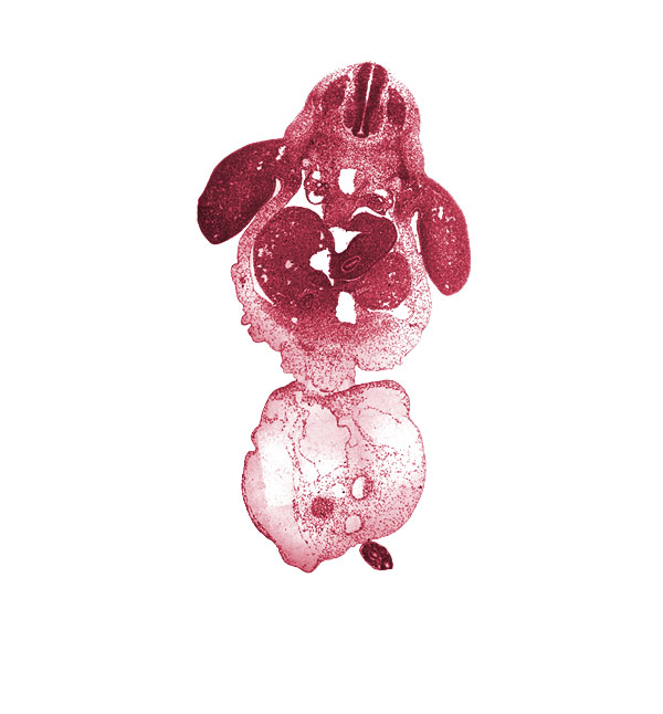 C-8 spinal ganglion, alar plate(s), allantois, amnion on surface of umbilical cord, basal plate, bile duct, caudal eminence, coccygeal somites, common umbilical vein, distal part of stomach, ductus venosus, floor plate, glomerular capsule, hepatic sinusoid, involuting right umbilical vein, left lobe of liver, left umbilical artery, lesser  sac, mesonephric duct, neural tube, notochord, post anal gut, postcardinal vein, right umbilical artery, roof plate, sclerotome, septum transversum, umbilical coelom, upper limb, ventral pancreas