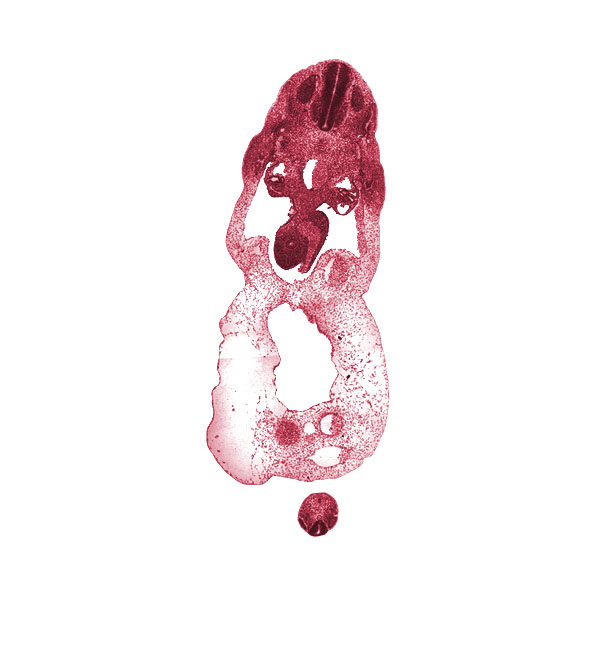 S-5 / Co-1 interganglion region, T-1 spinal ganglion, allantois, aorta, common umbilical vein, dermatome, dermatomyotome, distal limb of midgut loop, involuting right umbilical vein, left umbilical artery, left umbilical vein, mammary crest, myotome, neural canal, neural tube, notochord, omphalomesenteric vein, peritoneal cavity, post anal gut, right umbilical artery, sclerotome, umbilical coelom, umbilical cord