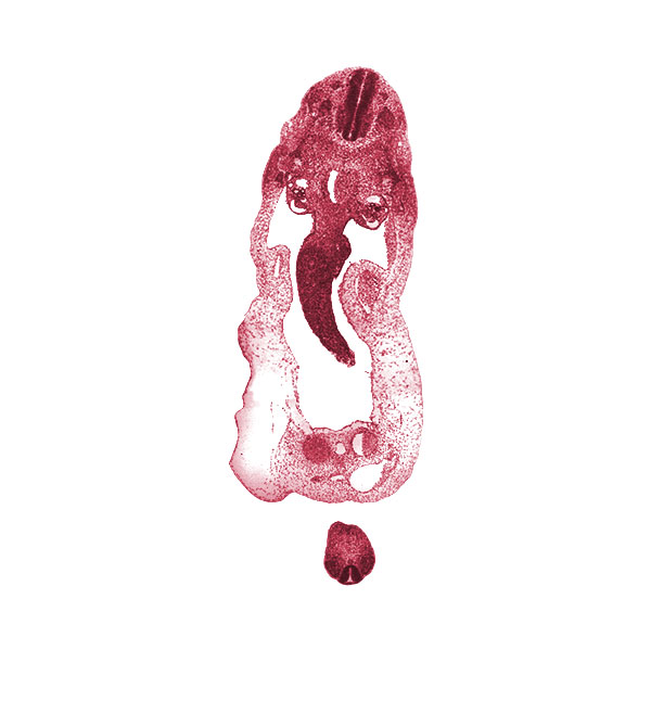 S-4 / S-5 interganglion region, allantois, aorta, caudal edge of T-1 spinal ganglion, cephalic part of T-2 spinal ganglion, cloacal membrane, common umbilical vein, dermatomyotome, dorsal mesentery, glomerulus, involuting right umbilical vein, junction of collecting tubule and mesonephric duct, left umbilical artery, left umbilical vein, mesonephric duct, neural tube, notochord, omphalomesenteric (superior mesenteric) vein, peritoneal cavity, postcardinal vein, proximal limb of midgut loop, right umbilical artery, roof plate, sclerotome, umbilical coelom, umbilical cord