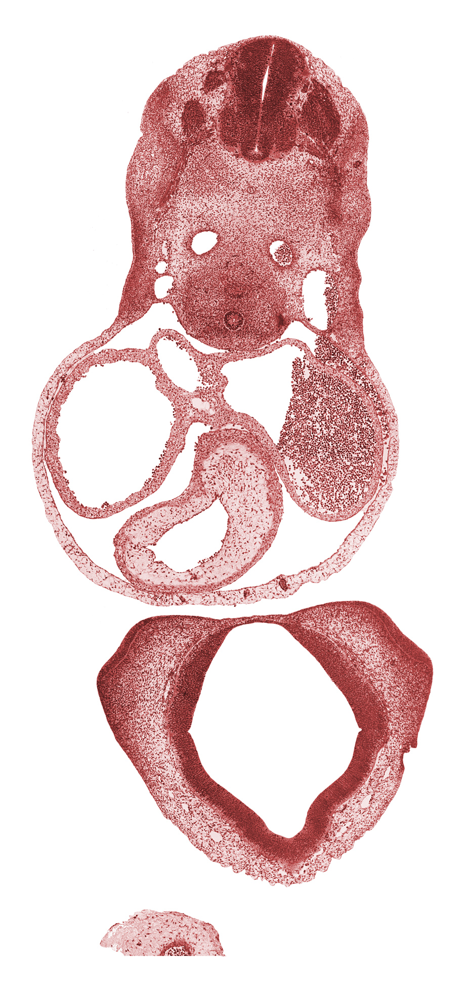 C-4 spinal ganglion, blood cells in pericardial cavity (artifact), cephalic edge of shoulder region, cerebral primordium (vesicle), conus cordis (outflow tract), corpus striatum, diencoel (third ventricle), endocardial tissue, esophagus primordium, left atrium, left precardinal vein, neural arch primordium, notochord, pericardial cavity, right atrium, right precardinal vein, sclerotome, sinus venosus, trachea