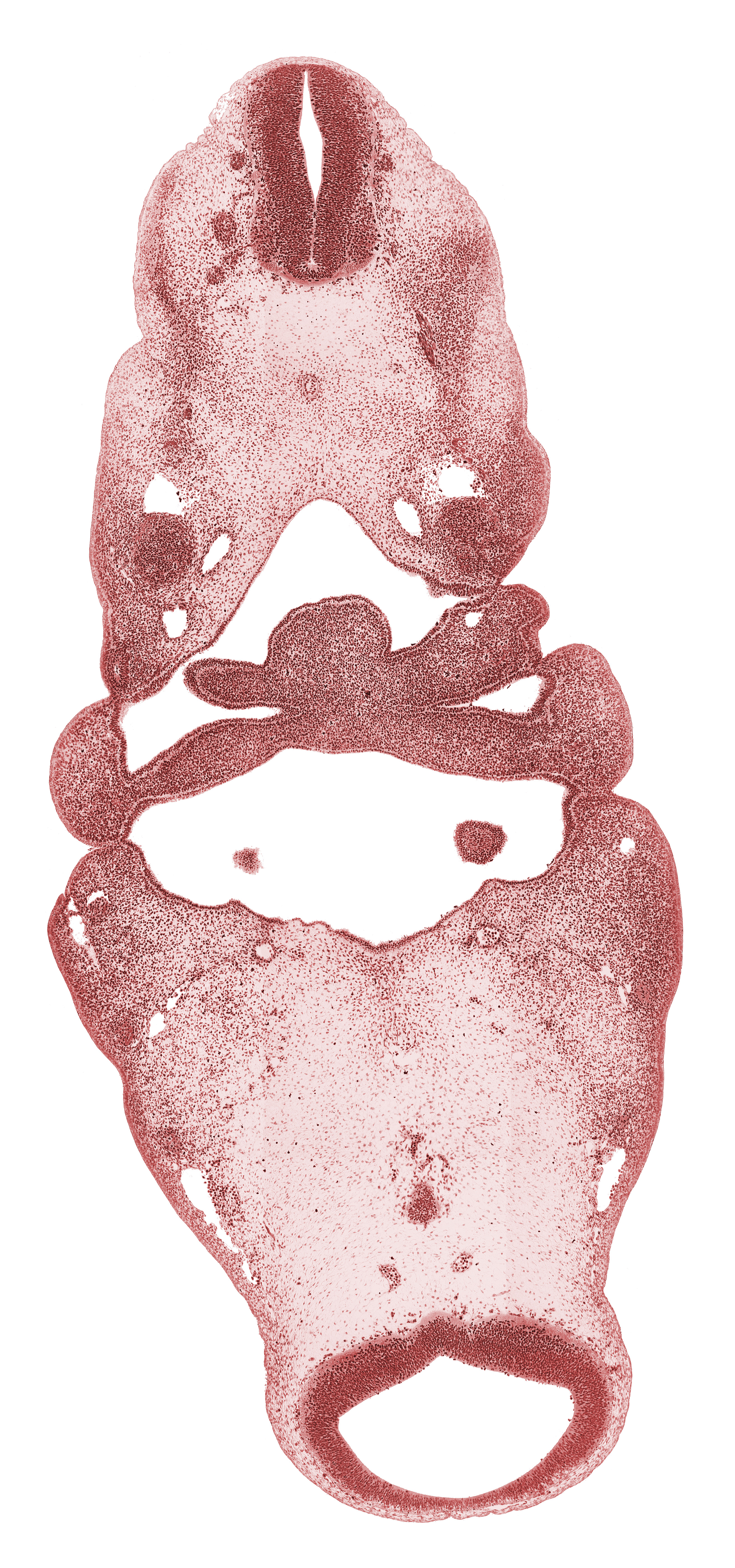 C-1 spinal nerve, cephalic edge of lateral lingual swelling of tongue, cephalic end of notochord, dorsal aorta, edge of diencephalon, foramen cecum of tongue, hypopharyngeal eminence of tongue, inferior ganglion of vagus nerve (CN X), internal carotid artery, mamillary region, mandibular prominence of pharyngeal arch 1, maxillary nerve (CN V₂), maxillary prominence of pharyngeal arch 1, mesencephalon (M1), neural canal, notochord, oral cavity, parachordal condensation, pharyngeal arch 2, pharyngeal arch 3, pharyngeal groove 1, pharyngeal groove 2, pharynx, posterior cerebral artery, precardinal vein, region of mesencephalic (cephalic) flexure, spinal accessory nerve (CN XI), spinal cord, stem of anterior dural venous plexus