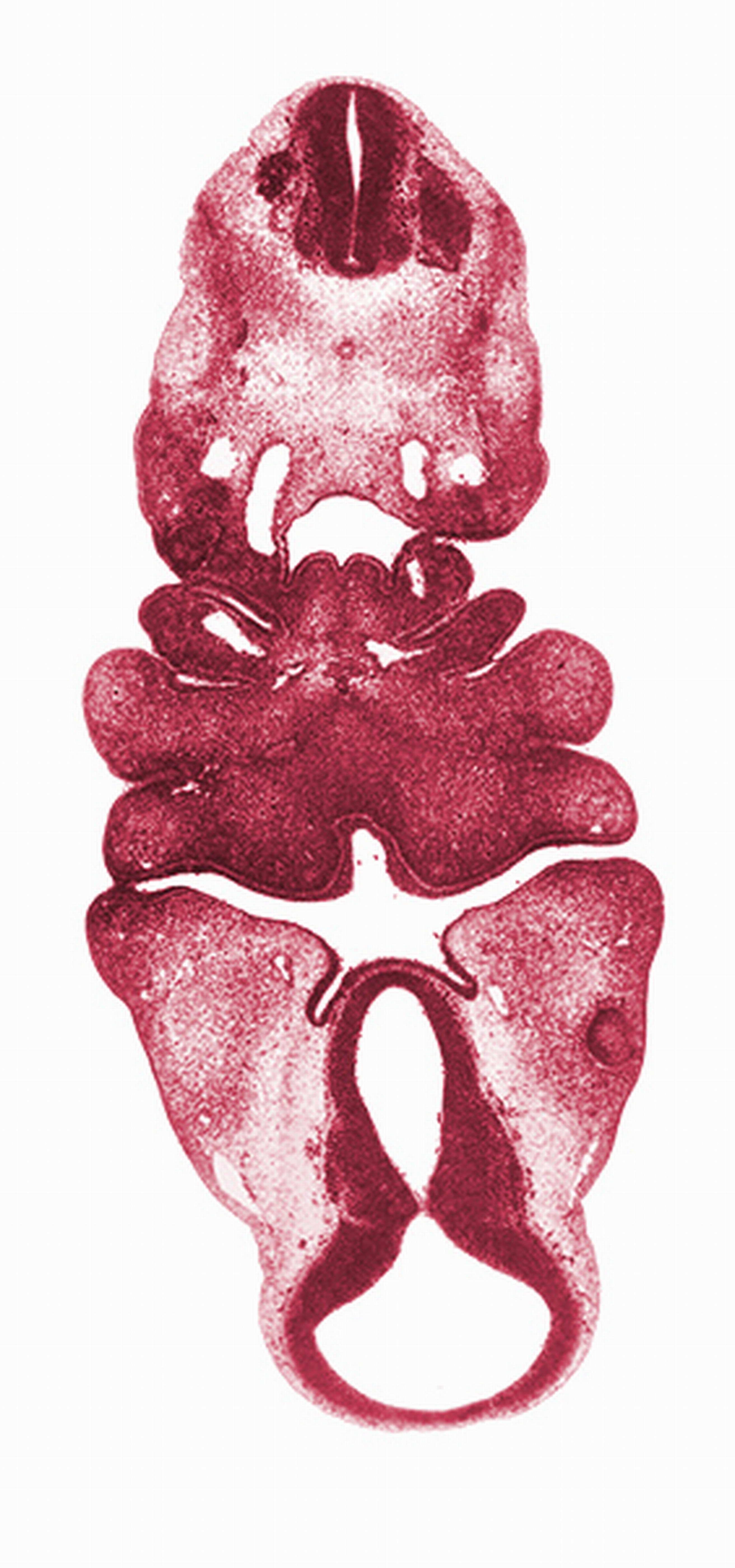 C-2 spinal ganglion, adenohypophysial pouch, aortic arch 3, aortic arch 4, bilobed thyroid gland, cervical sinus, diencephalon, diencoel (third ventricle), dorsal aorta, dorsal thalamus, edge of optic cup, inferior ganglion of vagus nerve (CN X), junction of diencoel (third ventricle) and mesencoel, mamillary recess, maxillary prominence of pharyngeal arch 1, median mandibular groove, mesencoel, neural arch primordium, notochord, oral fissure, pharyngeal arch 1, pharyngeal arch 2, pharyngeal arch 3, pharyngeal arch 4, pharyngeal groove 1, pharyngeal pouch 2, pharyngeal pouch 3, precardinal vein, presumptive nasopharynx, pretectum, primordial maxillary vein, spinal accessory nerve (CN XI)