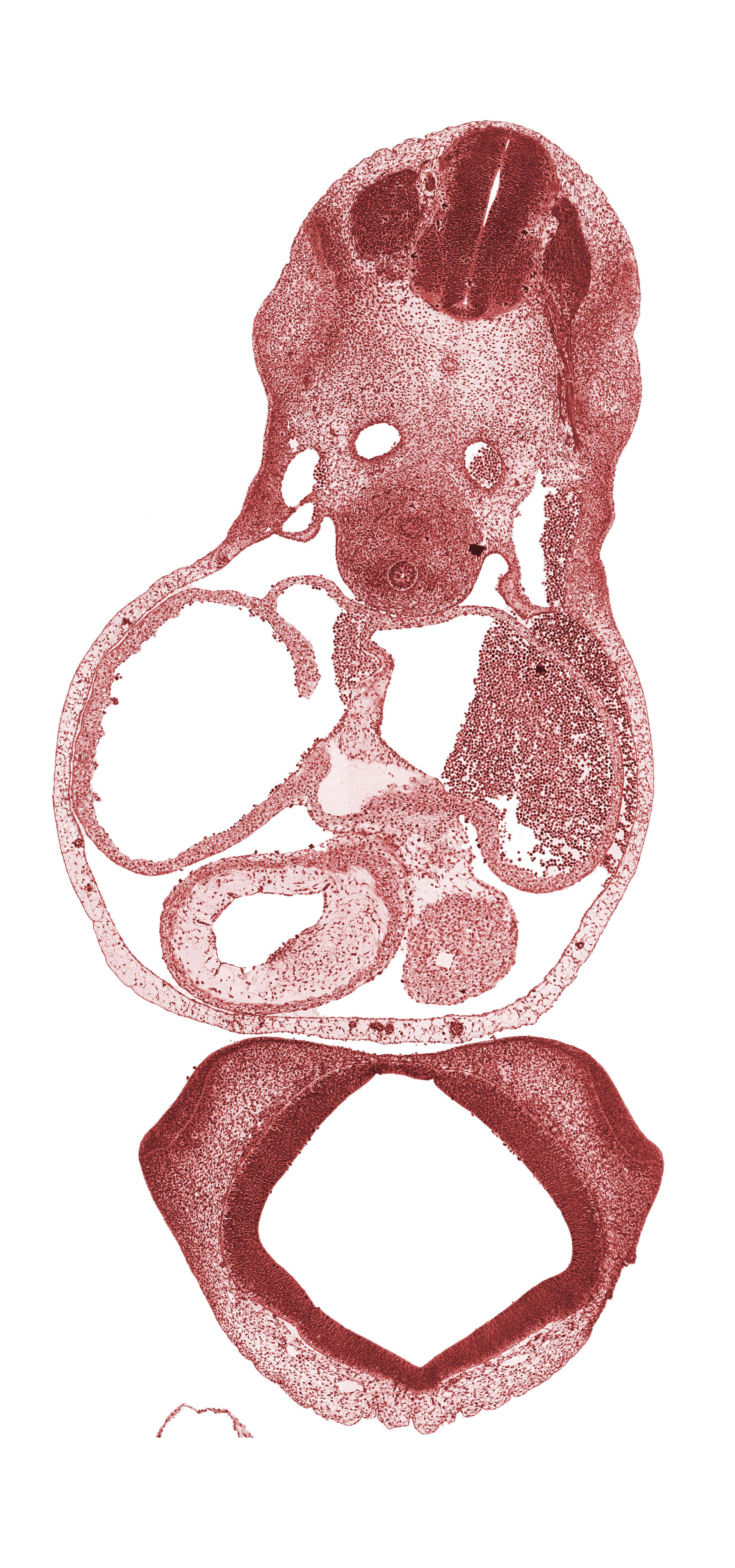 C-4 dorsal root, C-4 spinal ganglion, C-4 ventral root, cephalic part of shoulder region, cervical plexus, conus cordis (outflow tract), diencoel (third ventricle), dorsal aorta, esophagus primordium, lateral nasal prominence, lateral ventricle, left atrium, left common cardinal vein, left precardinal vein, left venous valve, left ventricle, medial nasal prominence(s), neural arch primordium, notochord, primary interatrial septum (septum primum), right atrium, right venous valve, sinus venosus, trachea