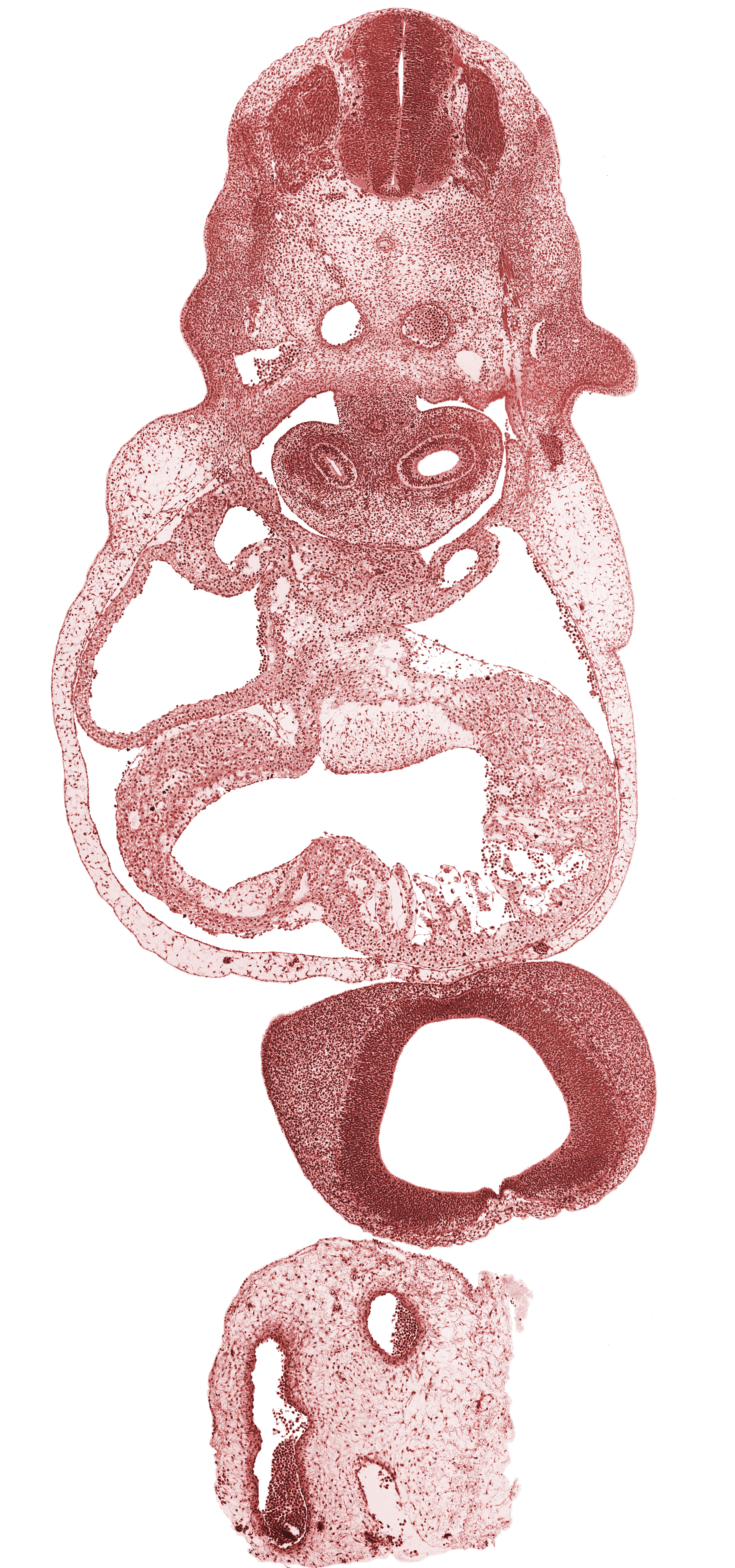 C-5 spinal ganglion, dermatome, dorsal aorta, frontal prominence, interventricular foramen, junction of lateral and medial nasal prominences, left common cardinal vein, left lung sac, left primary bronchus, left ventricle, notochord, pericardial cavity, pericardioperitoneal canal (pleural cavity), pleuropericardial membrane, postcardinal vein, precardinal vein, right atrium, right common cardinal vein, right lung sac, right primary bronchus, telencephalon medium, trabecular part of right ventricle, upper limb