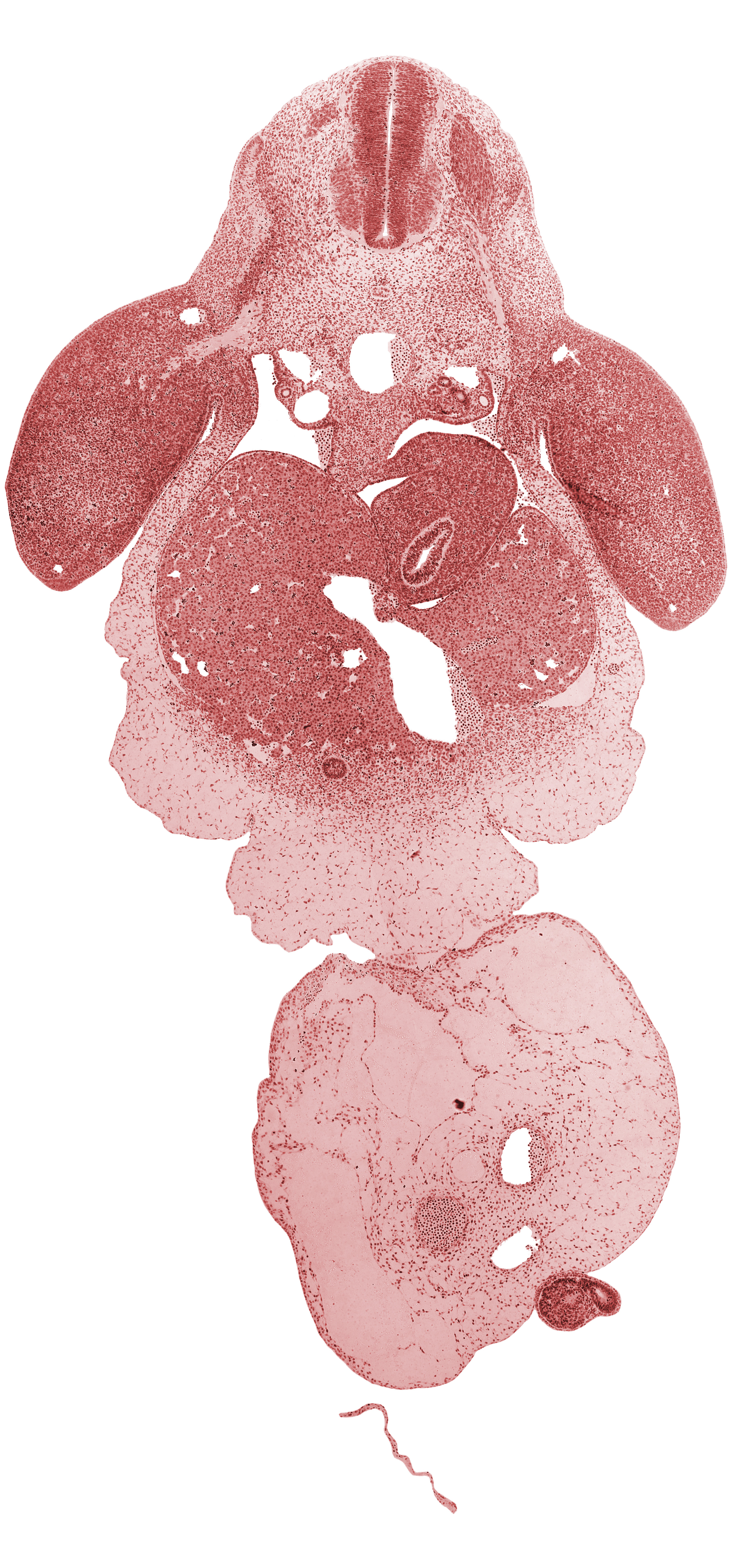 C-8 spinal ganglion, C-8 spinal nerve, C-8 ventral root, amnion on surface of umbilical cord, aorta, brachial plexus, caudal eminence, common umbilical vein, ductus venosus, gall bladder primordium, left lobe of liver, left umbilical artery, lesser sac, marginal vein, mesonephric duct, neural tube, notochord, peritoneal cavity, post anal gut, postcardinal vein, right lobe of liver, right umbilical artery, septum transversum, spleen primordium, stomach, umbilical coelom