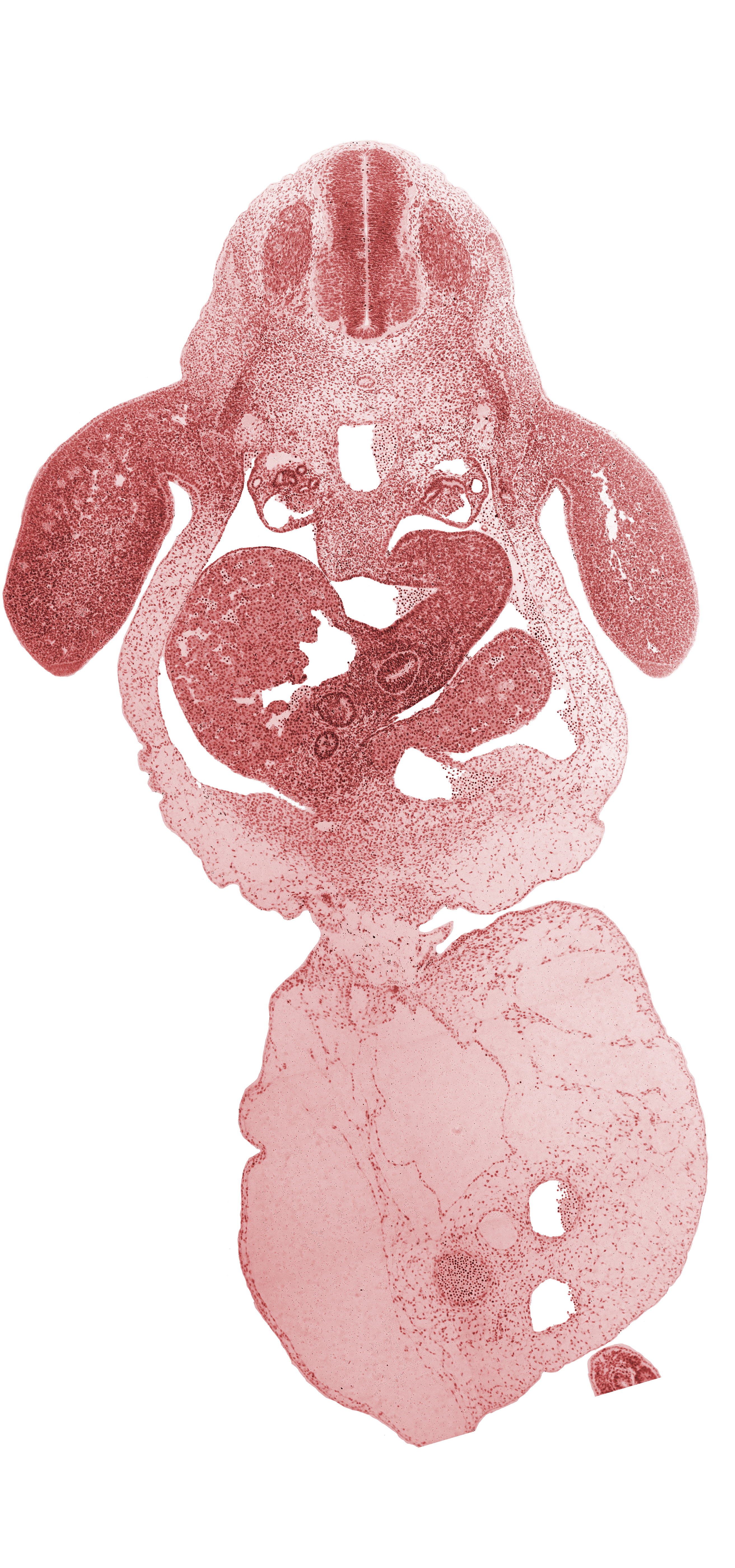 C-8 spinal ganglion, amnion on surface of umbilical cord, bile duct, caudal eminence, coccygeal somites, common umbilical vein, dorsal mesentery, hepatic duct(s), hepatic sinusoid, intermediate zone, junction of ductus venosus and left umbilical vein, junction of duodenum and stomach, junction of umbilical cord and ventral body wall, left lobe of liver, left umbilical artery, lesser sac, marginal zone, mesonephric duct, mesonephric tubule(s), neural canal, neural tube, peritoneal cavity, post anal gut, right umbilical artery, septum transversum, umbilical coelom, umbilical cord, upper limb, ventricular zone