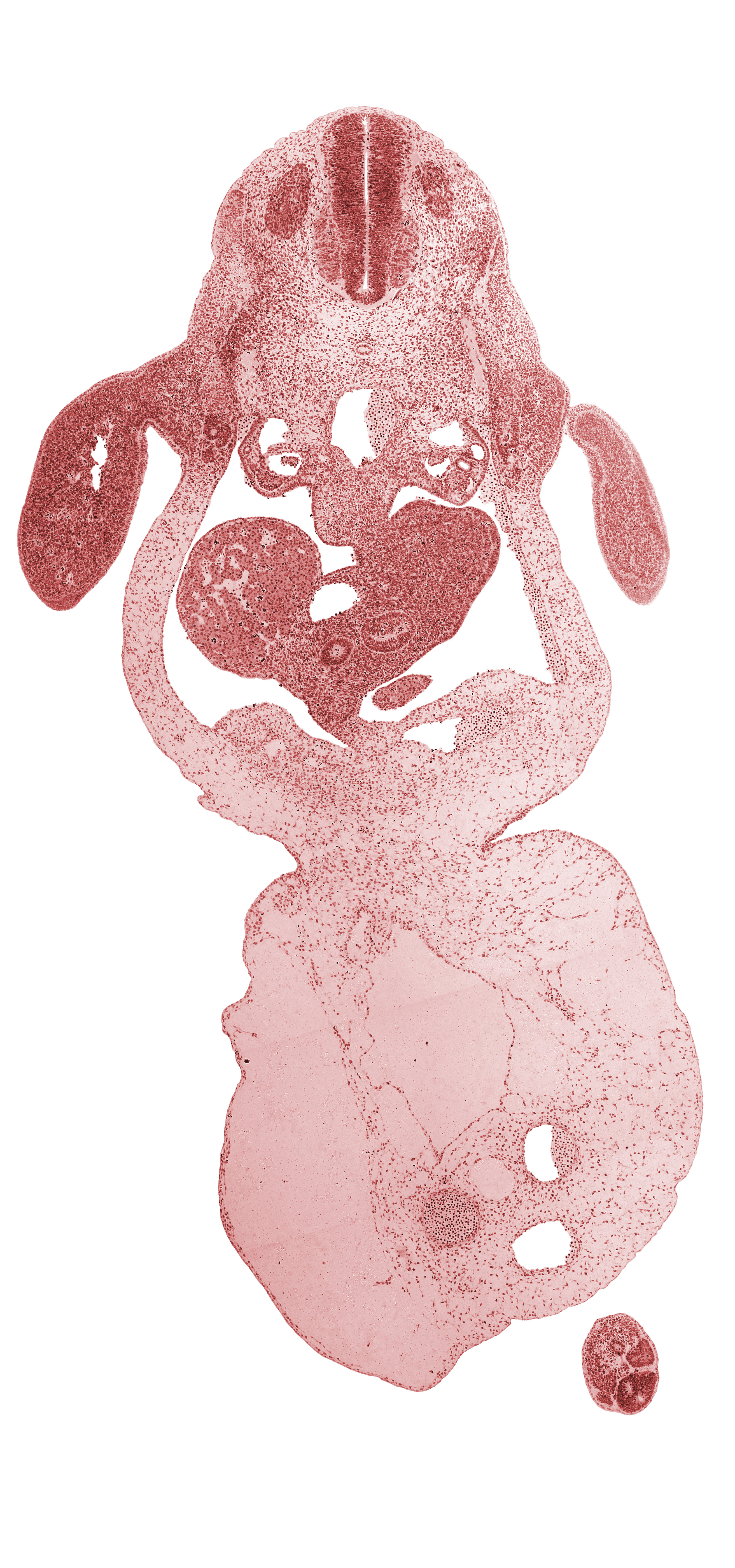 C-8 spinal ganglion, allantois, aorta, caudal edge of left lobe of liver, caudal eminence, coccygeal somites, common umbilical vein, dermatome, dorsal mesogastrium, duodenum, epiploic foramen, involuting right umbilical vein, junction of bile duct and hepatic ducts, left umbilical artery, left umbilical vein, lesser sac, myotome, neural tube, notochord, omphalomesenteric (superior mesenteric) vein, post anal gut, right lobe of liver, right umbilical artery, sclerotome, septum transversum, umbilical coelom, umbilical cord, upper limb