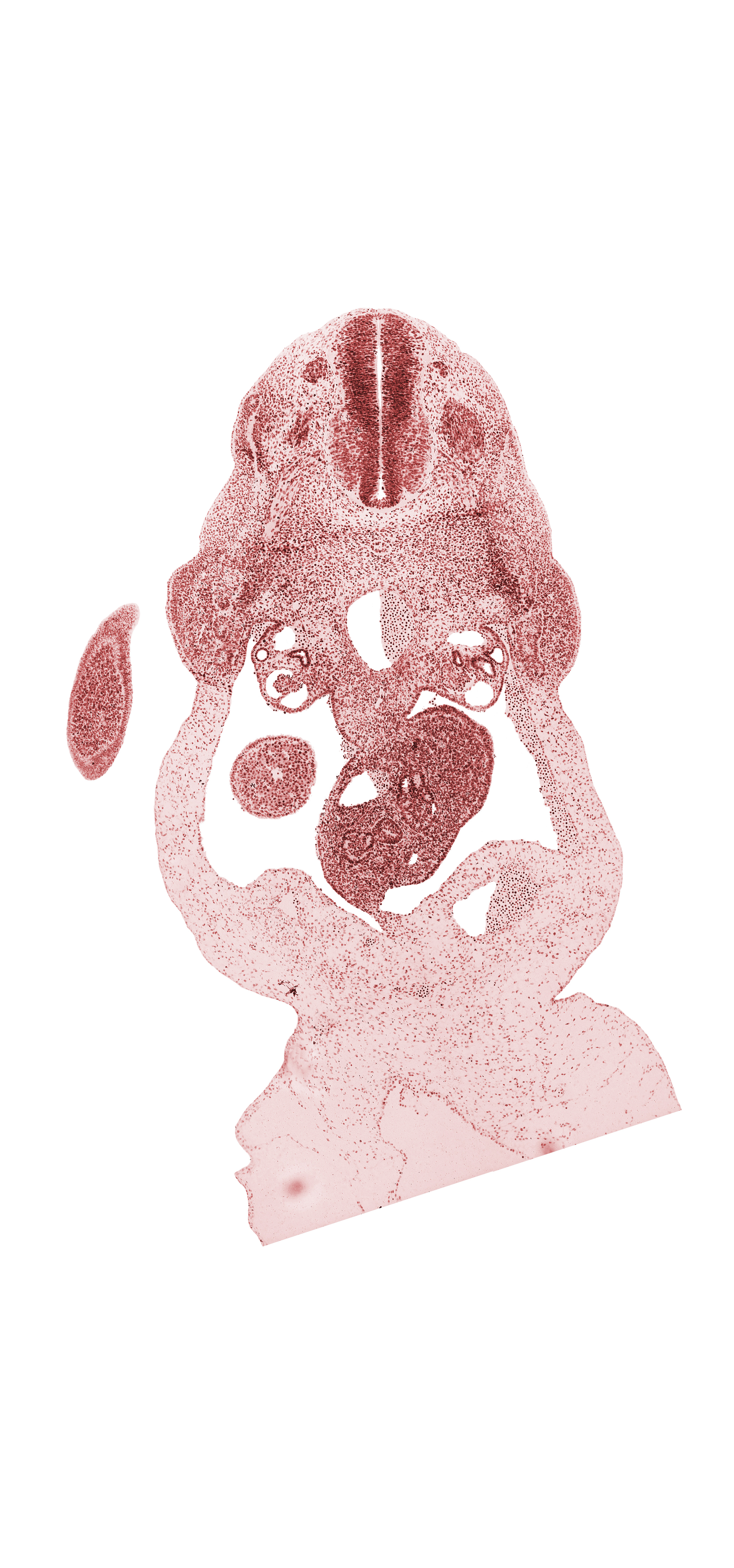 allantois, caudal edge of liver, caudal end of upper limb, cephalic edge of T-1 spinal ganglion, coccygeal somites, common umbilical vein, dorsal pancreas, duodenum, involuting right umbilical vein, left umbilical artery, left umbilical vein, mammary crest, mesonephros, neural tube, notochord, omphalomesenteric (superior mesenteric) vein, right umbilical artery, sclerotome, umbilical coelom, umbilical cord, ventral pancreas